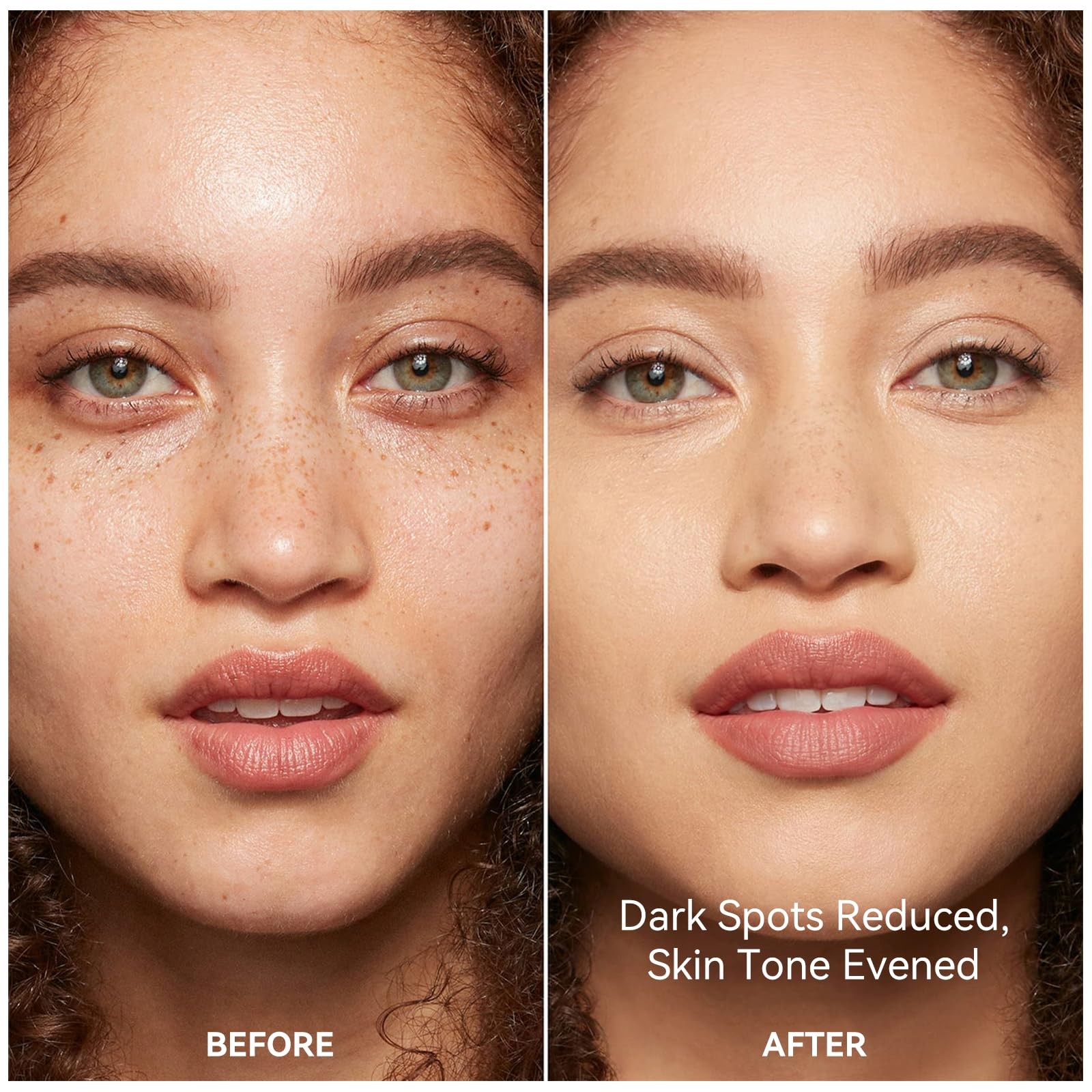 Dark Spot Remover for Face and Body Serum, Dark Spot Corrector for Freckles M…