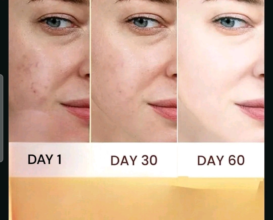 La Roche-Posay 3 In 1 Mela B3 Set Serum SPF 30 Dark Spot Brightening [USA Stock]