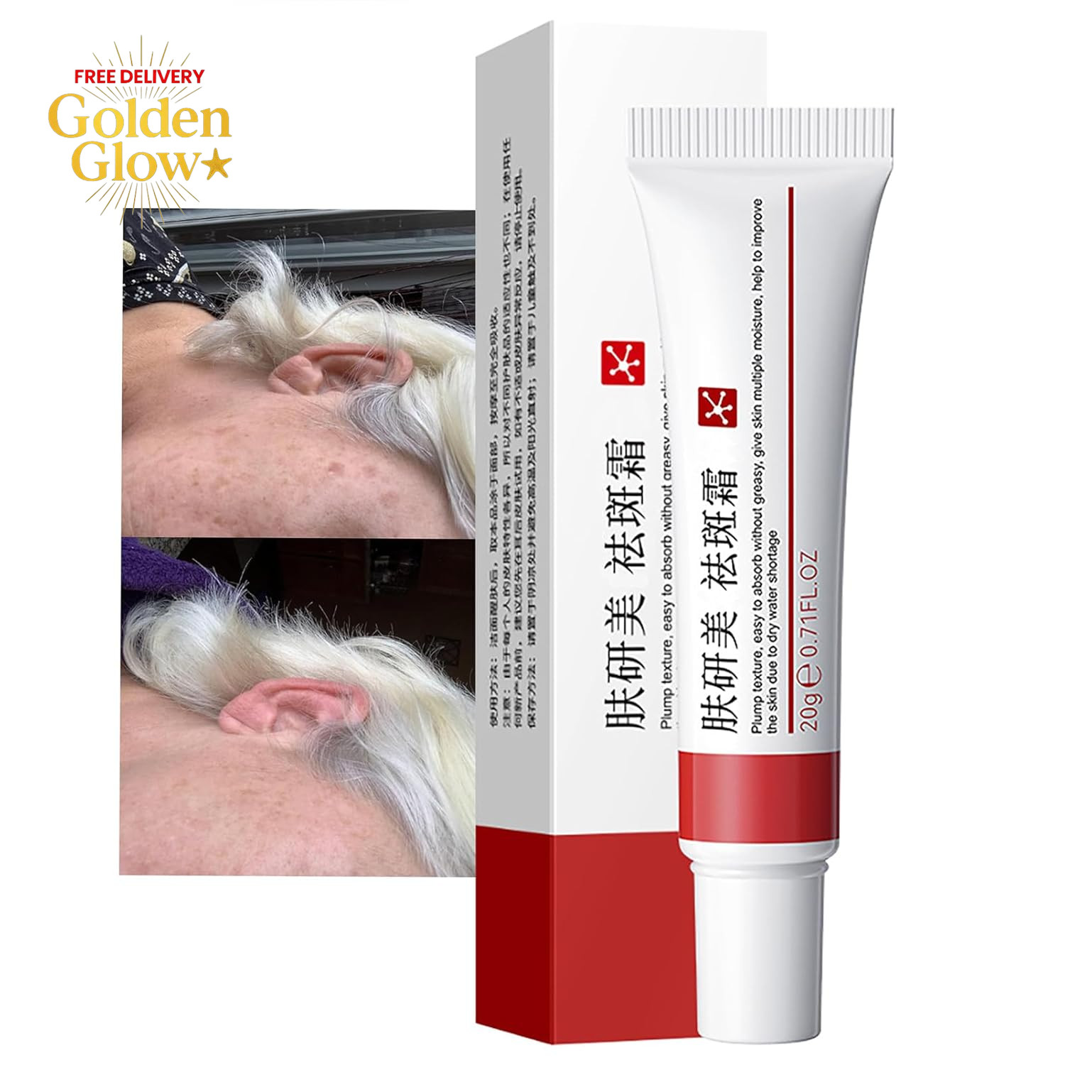 3 PCS Crema Para Manchas Oscuras En La Cara,Dark Spot Remover for Face,Freckles