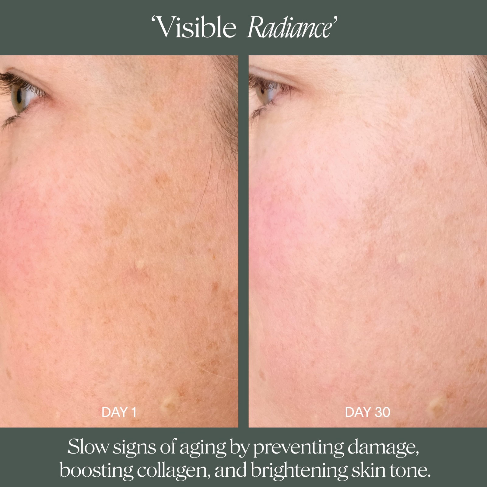 Doctor Rogers Restore Doctor Rogers Day Preventive Treatment. Restoring