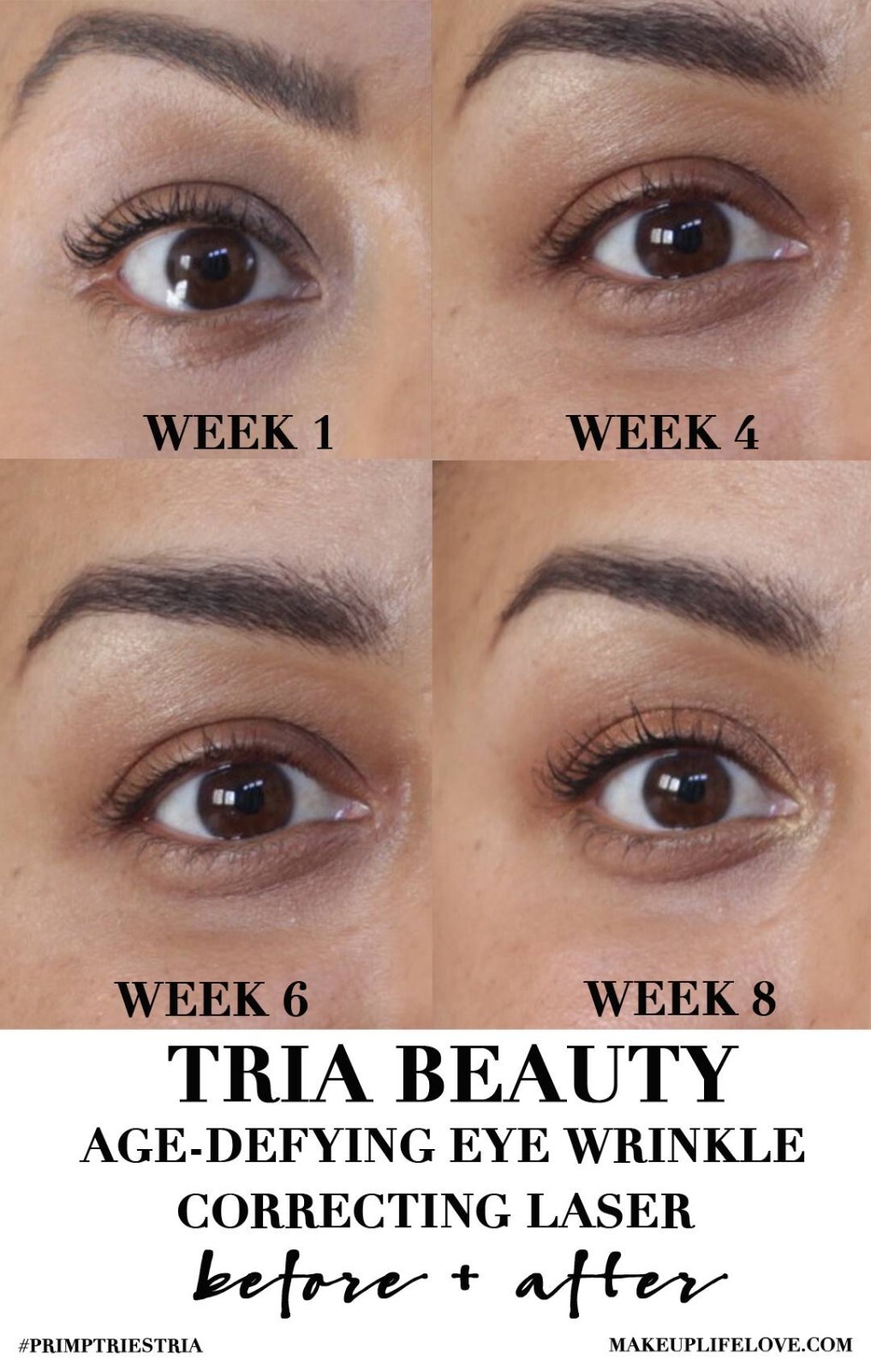 TRIA Age-Defying Skincare NOURISHING EYE RENEWAL CREAM .5fl.oz 15mL – New w/Box