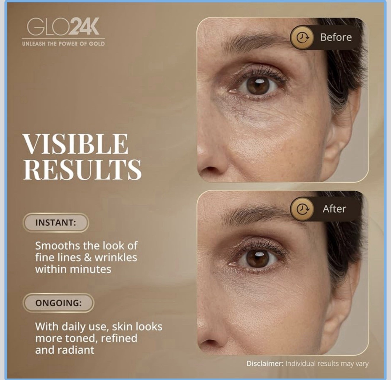 3 GLO 24k Face Lift In Your Syringe ( Face & Eyes) Instant !