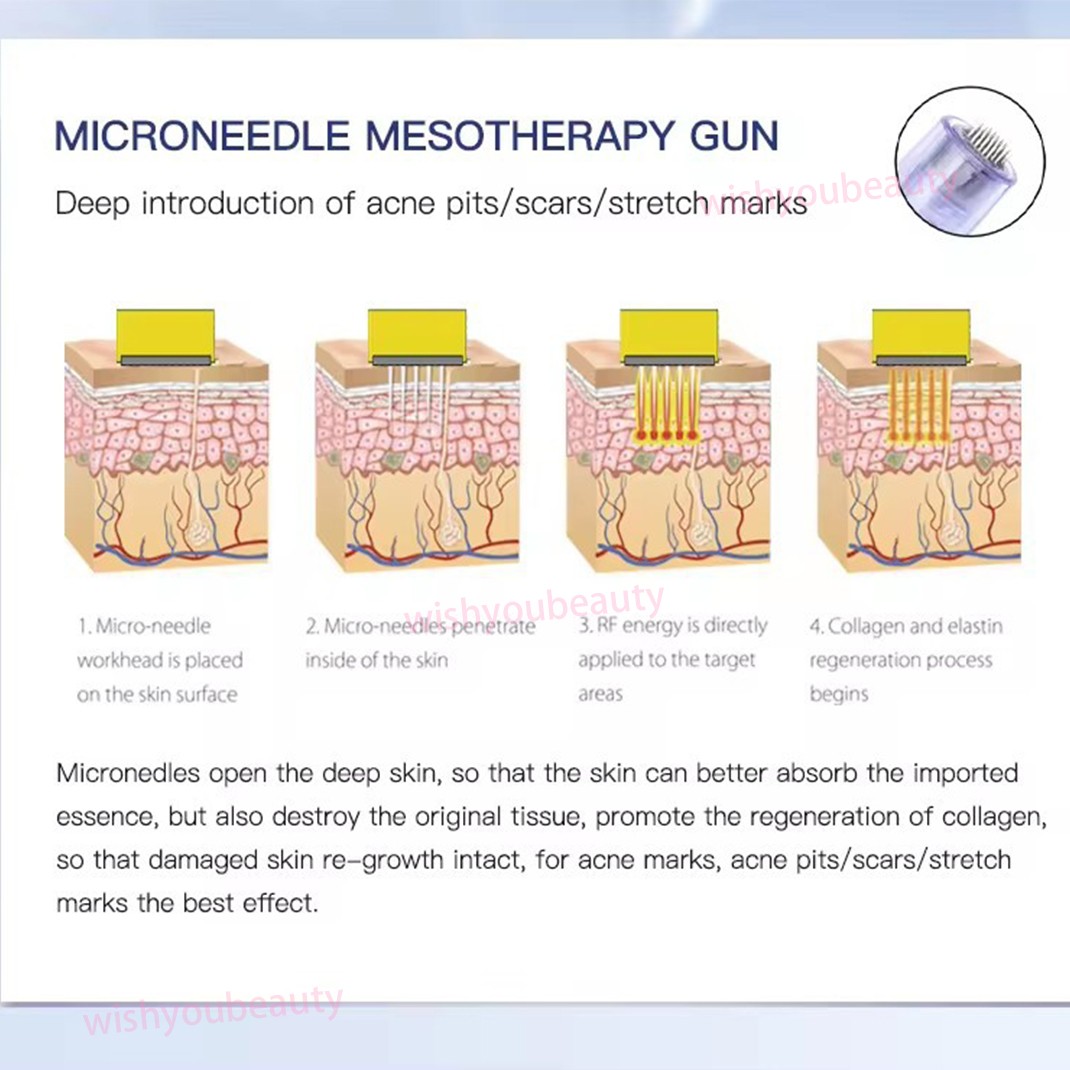 Home Use Skin Beauty Micro Pen with 42 Pin Replacement Needle Accessories