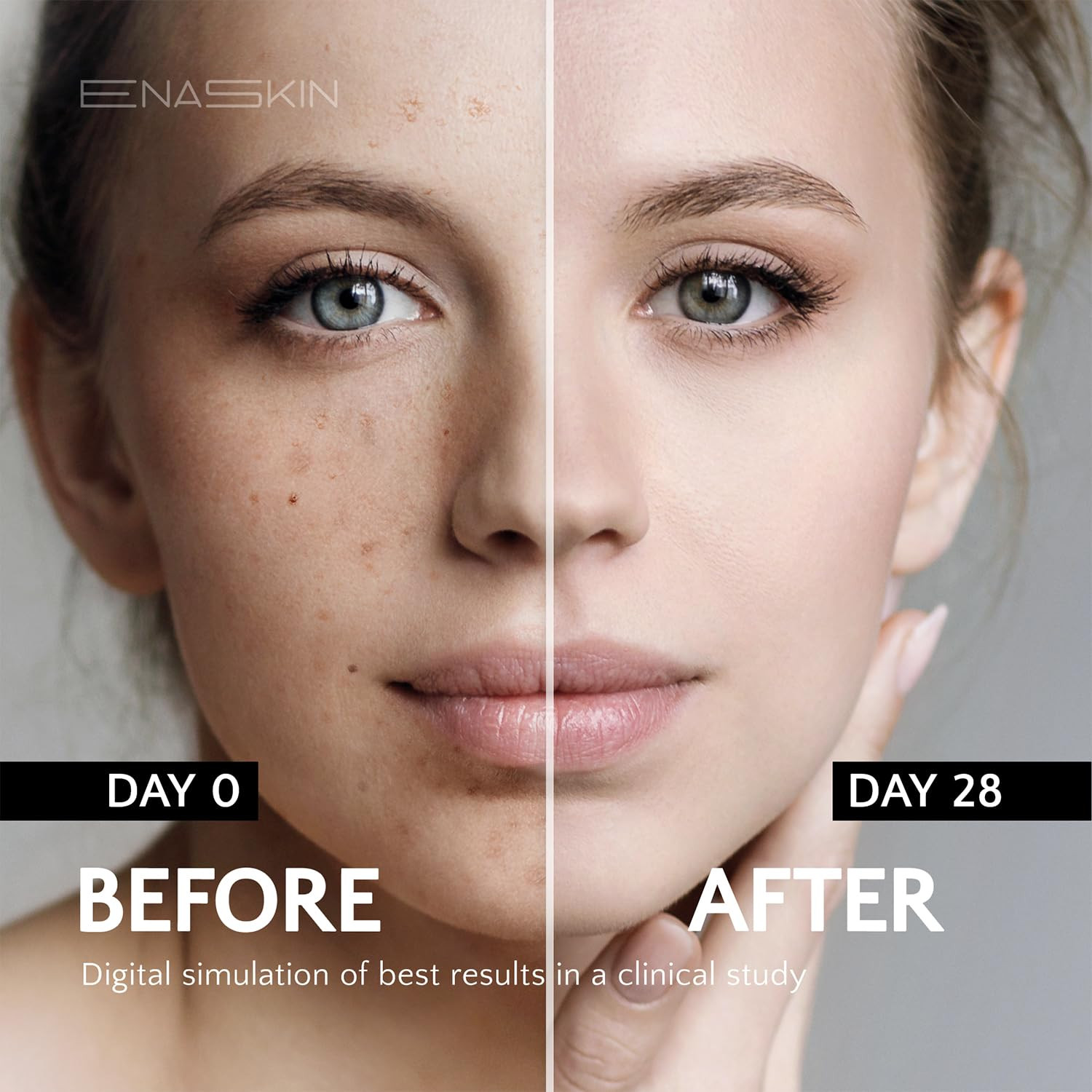 Dark Spot Remover Face & Body Serum: Age Spot Sun Spot Freckles Melasma Brown Sp
