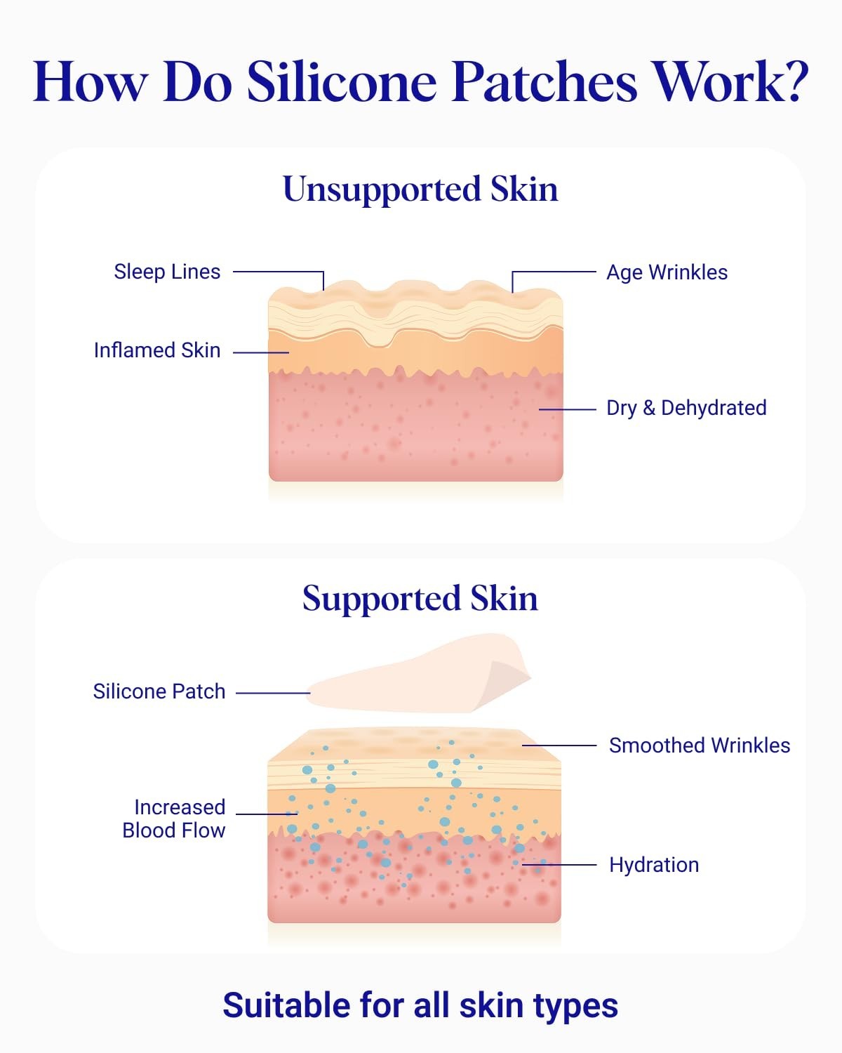 Reusable Forehead Wrinkle Patches – Medical Grade Silicone Smoothing Pads 2-Pack