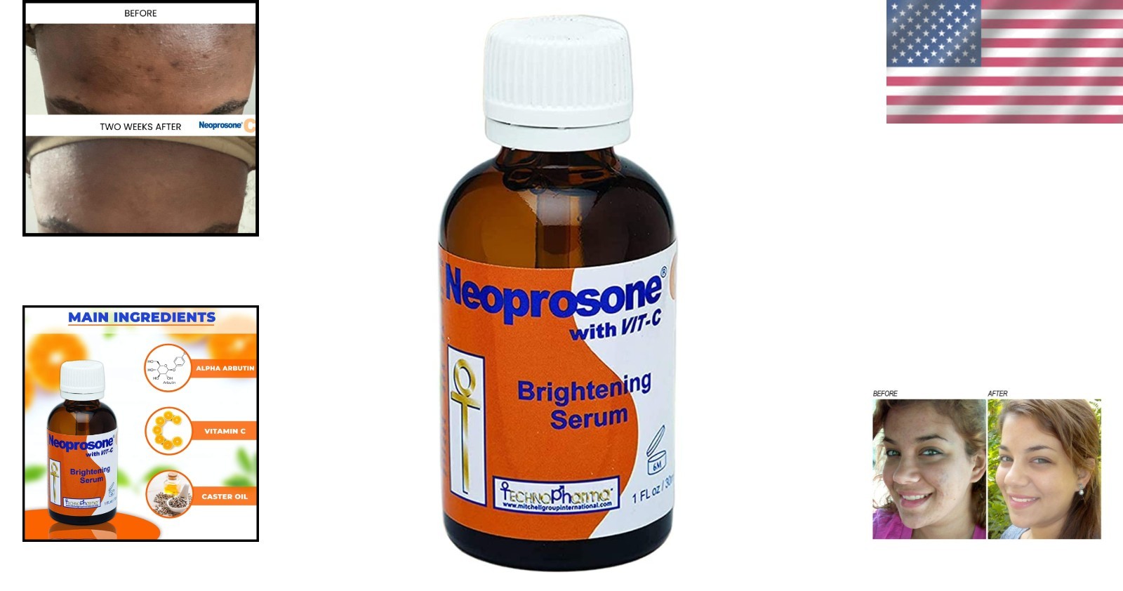 30ml Vitamin C Brightening Serum with Alpha Arbutin & Castor Oil for Oily Skin