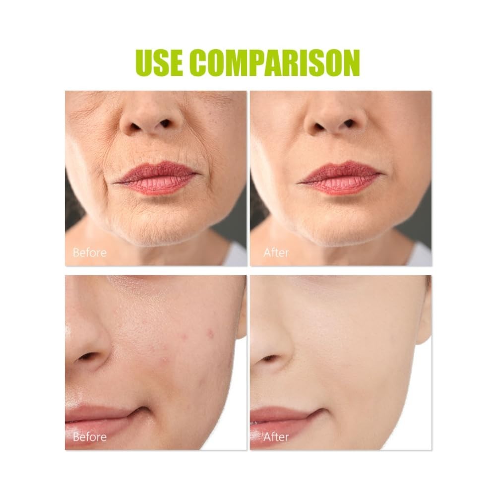 AICHUN BEAUTY Licorice Root Moisturizing Body Skin Oil Spots Anti-Aging 100ml
