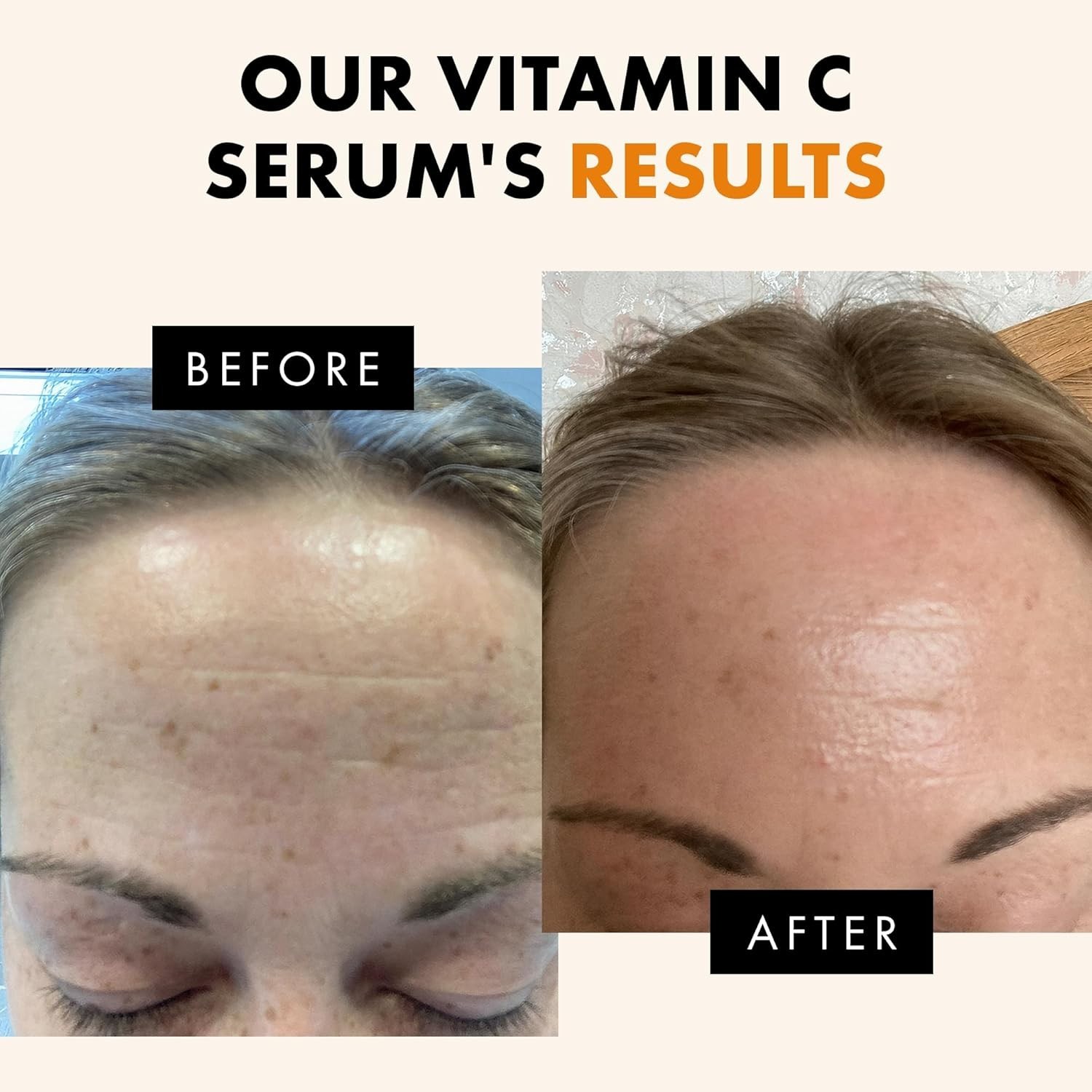 Eclat Vitamin C Face Serum, Brightening Facial Treatment with Vitamin E, 1 fl oz