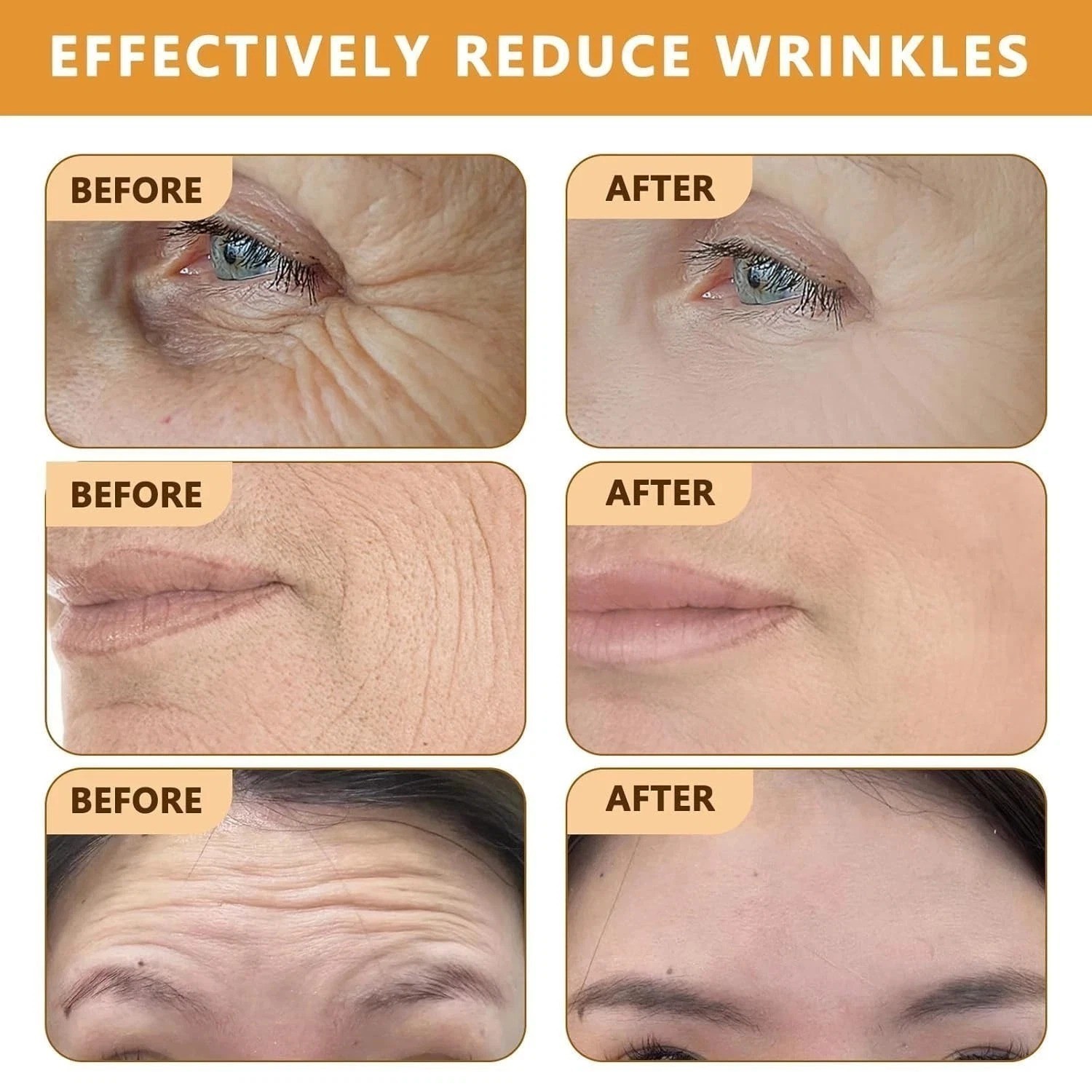 2pcs Bee Venom Wrinkle Removal Cream,Anti-Aging Face for All Skin Type Wrinkle