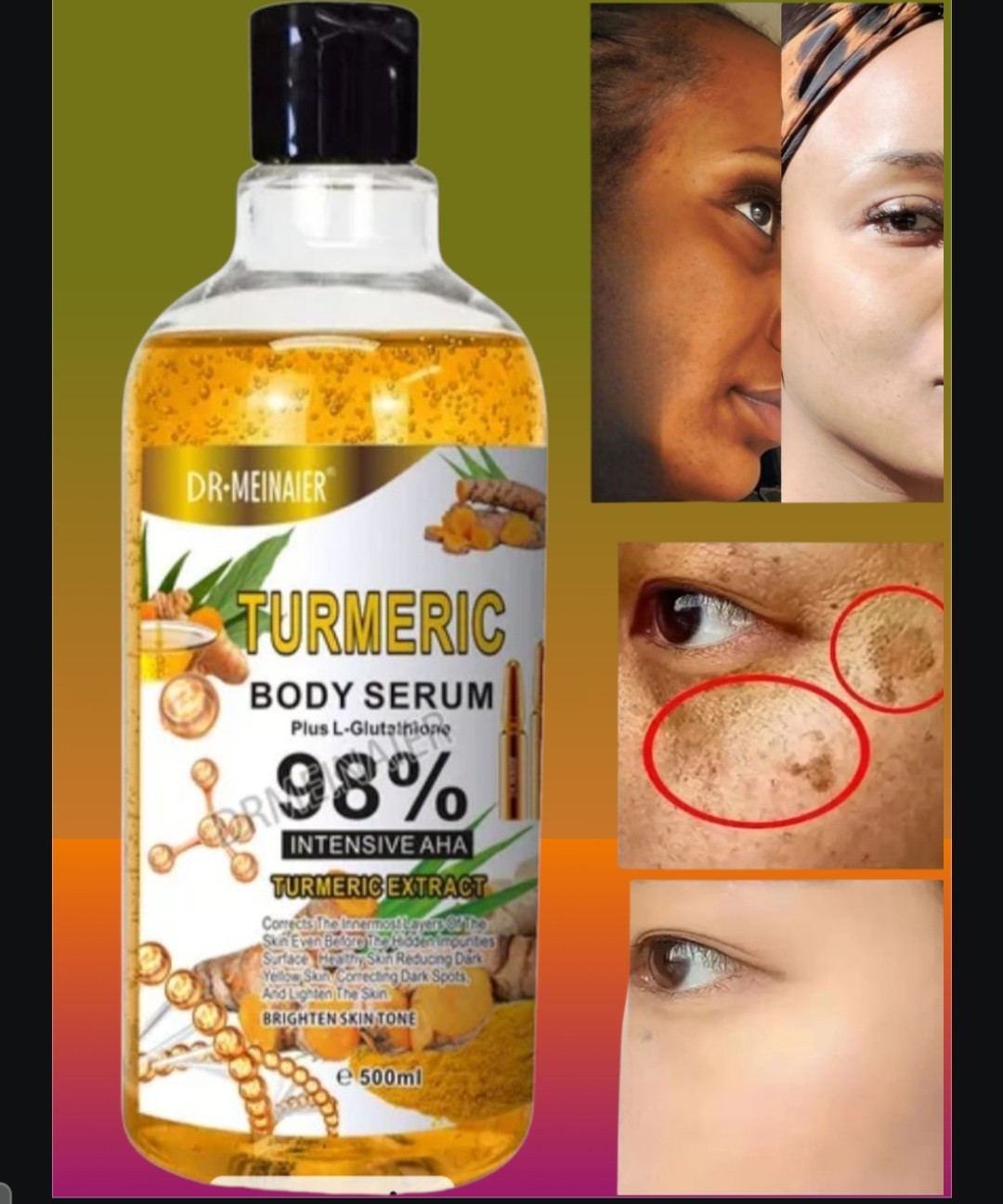 Turmeric Skin Brightening Serum Face & Body Whitening Essence 500ml, [USA Stock]