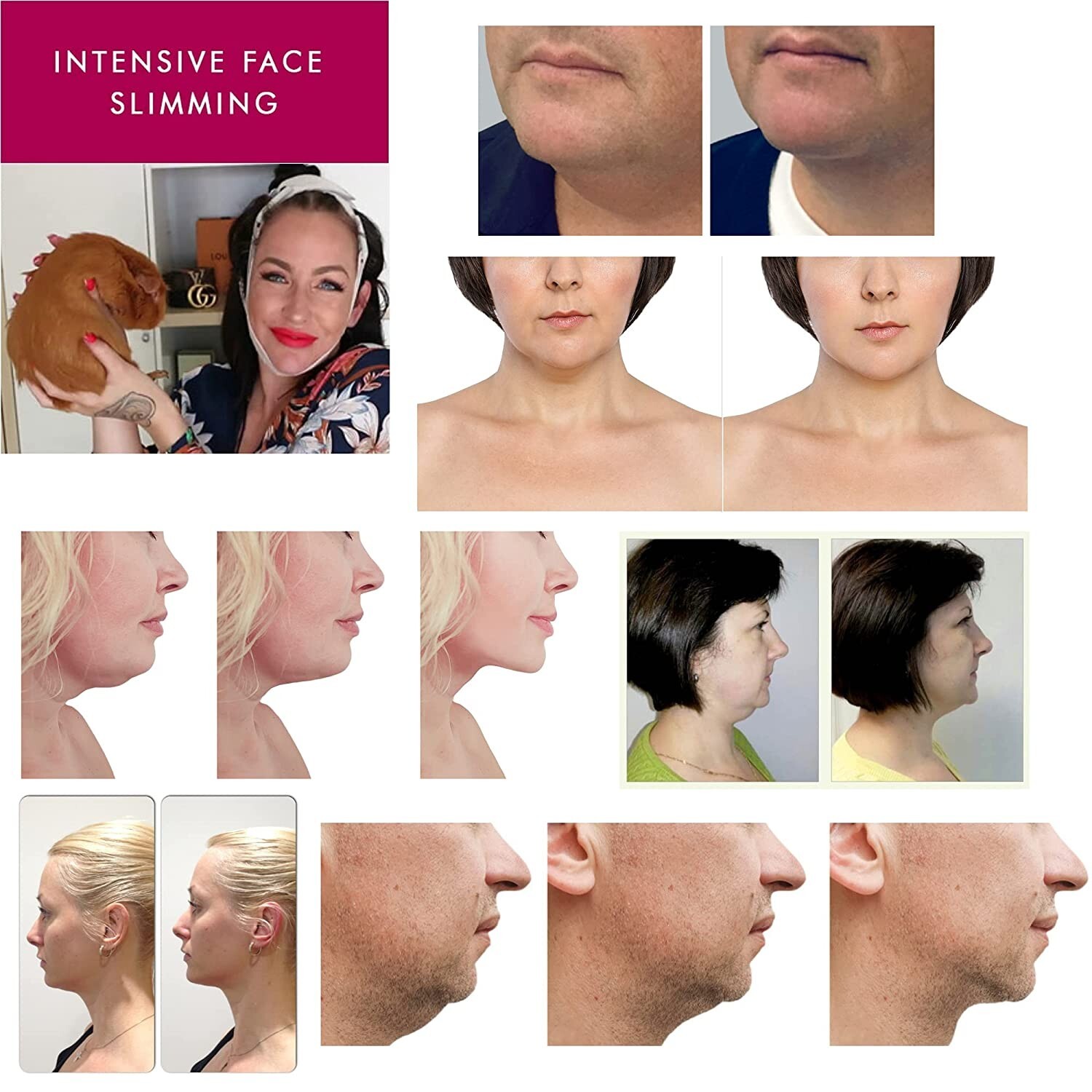 Double Chin Reducer Neck Firming Face Shaping Toning Strap and Facial Masks