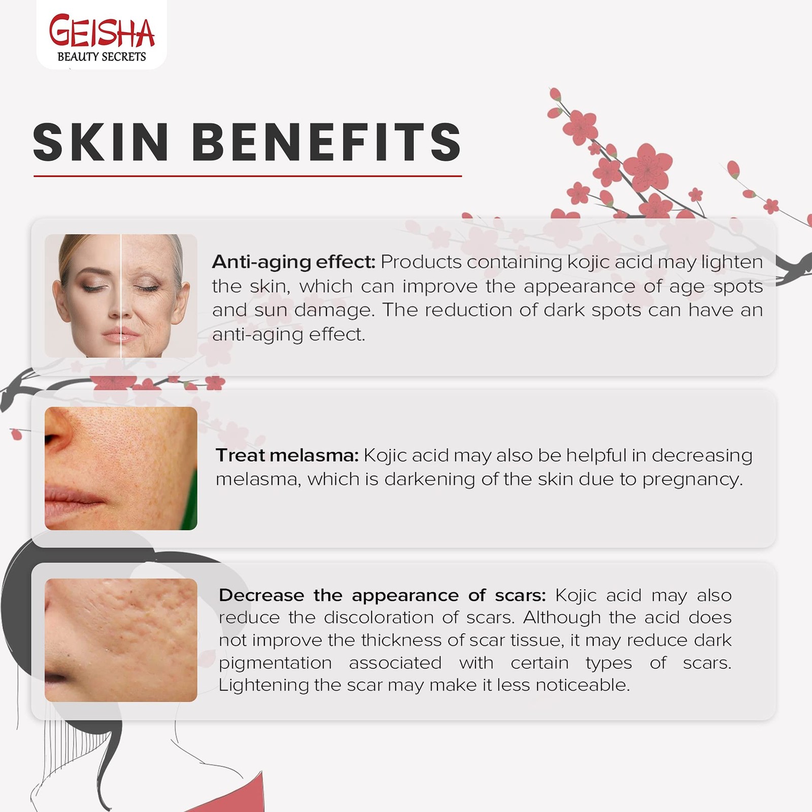 Geisha, Kojic Acid Serum, 1 Fl oz / 30ml, Helps to Reduce Dark Spots on Face,…