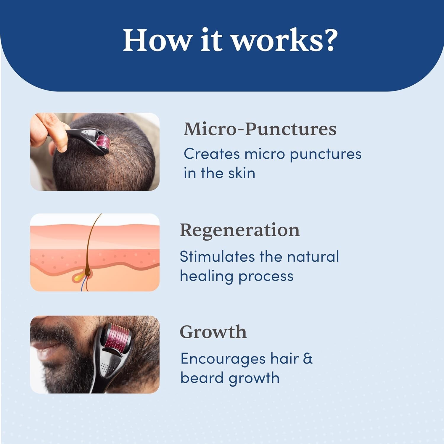 Man Matters Derma Roller with 540 Titanium Alloy Micro Needles 0.5 mm Hair grows