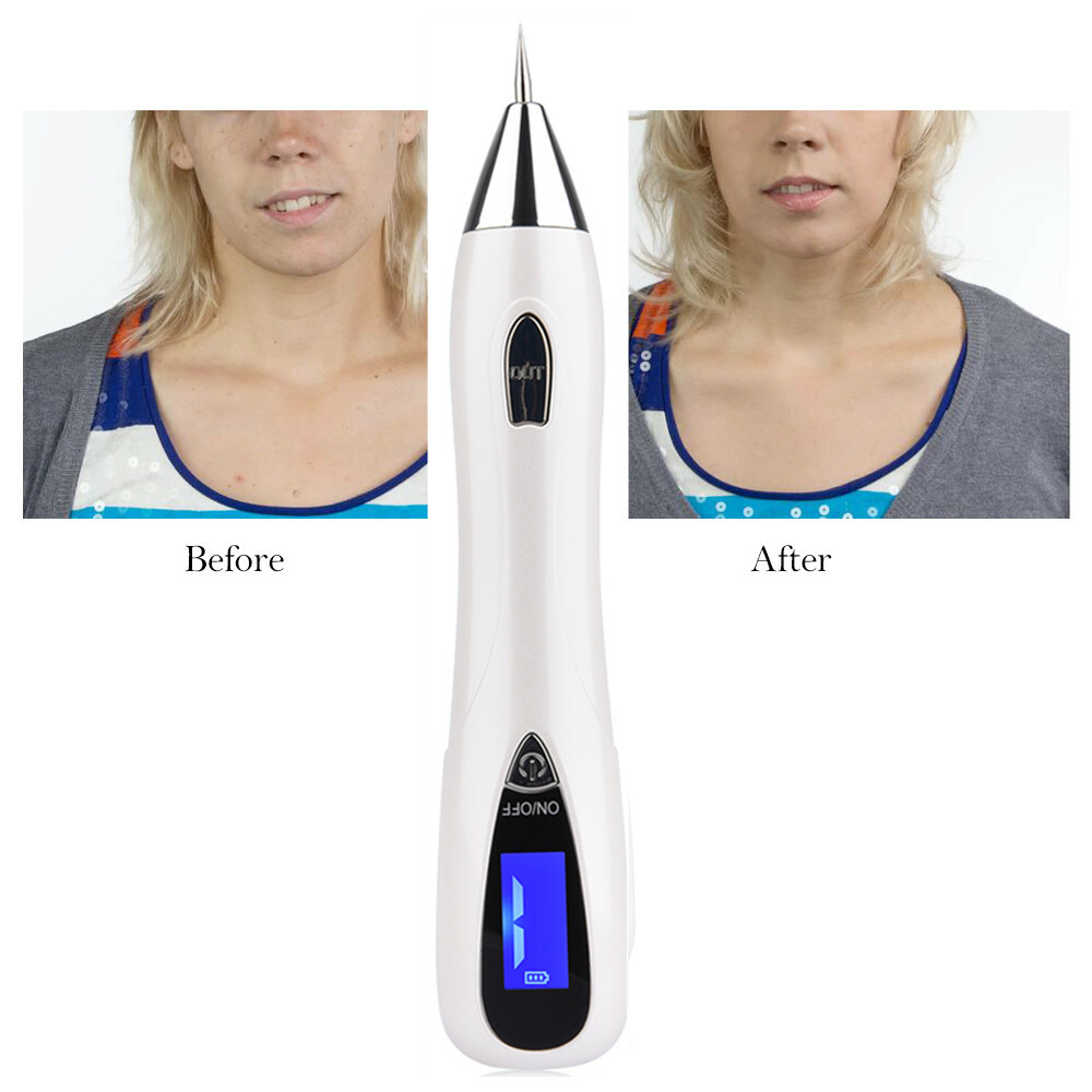 2023 Fibroblast Plasma Pen for Face Eyelid Lift Wrinkle Spot Removal Plasmapen