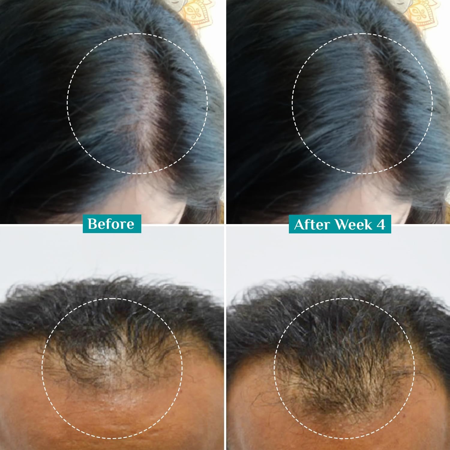 Pilgrim Redensyl 3% + Anagain 4% Advanced Hair Growth Serum 50ml
