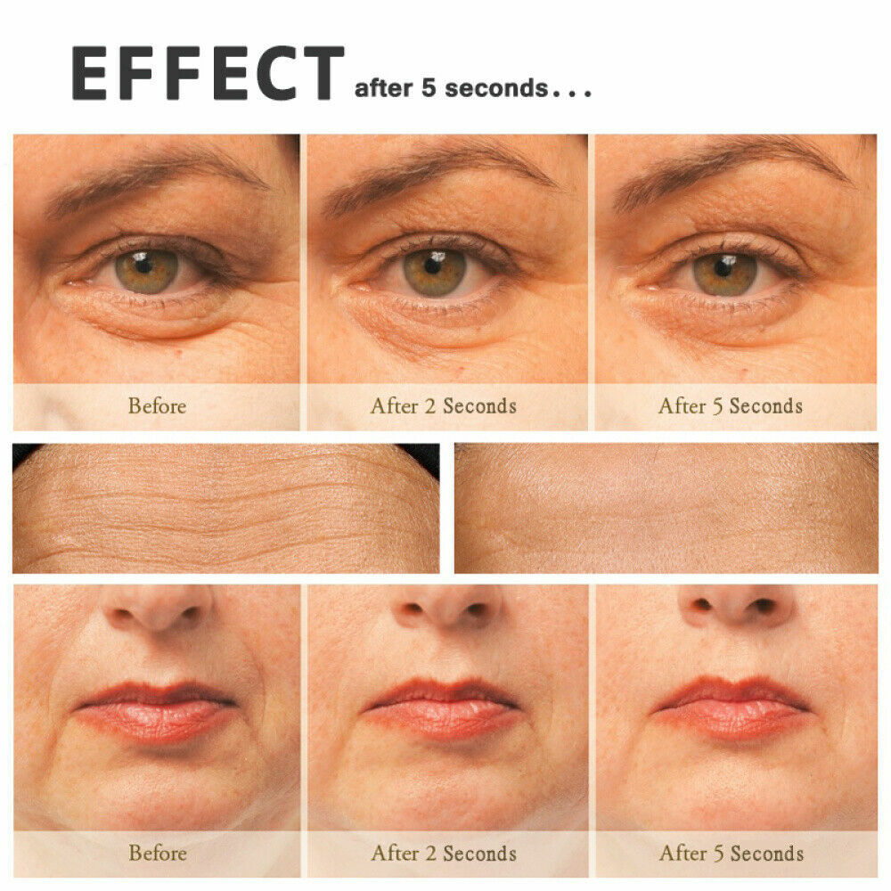 5 Seconds Instant Wrinkle Remover Cream Skin Tightening Hyaluronic Acid Serum