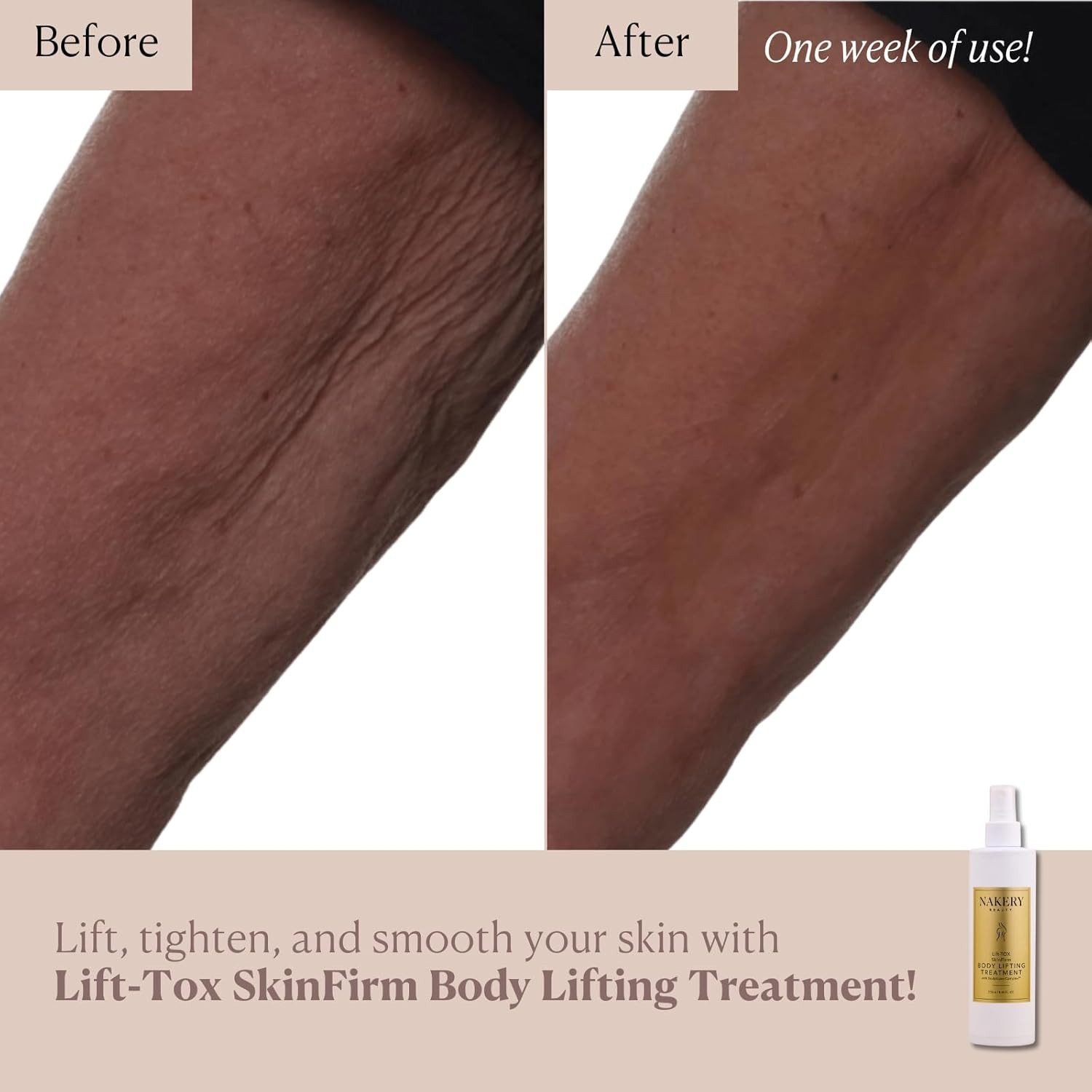 Nakery Lift-TOX SkinFirm Body Firming & Tightening Spray, Unscented 250 mL