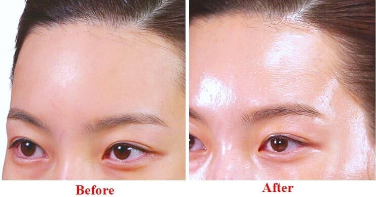 Ultimate Rejuvenation ─PDRN(20%) + Copper Peptide(8%) Glutathione Ampoule (5ml)