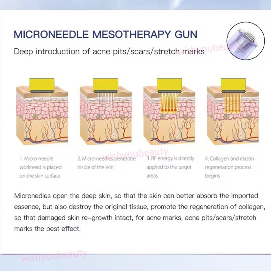 Micro Pen Mesotherapy~Gun With 10Pcs 12Pin Replacement Needles Cartridges Tips