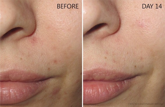 Niacinamide 10% +Zink 1% +Hyaluronic Acid | Acne/Blemish/Oil Control Serum/Cream