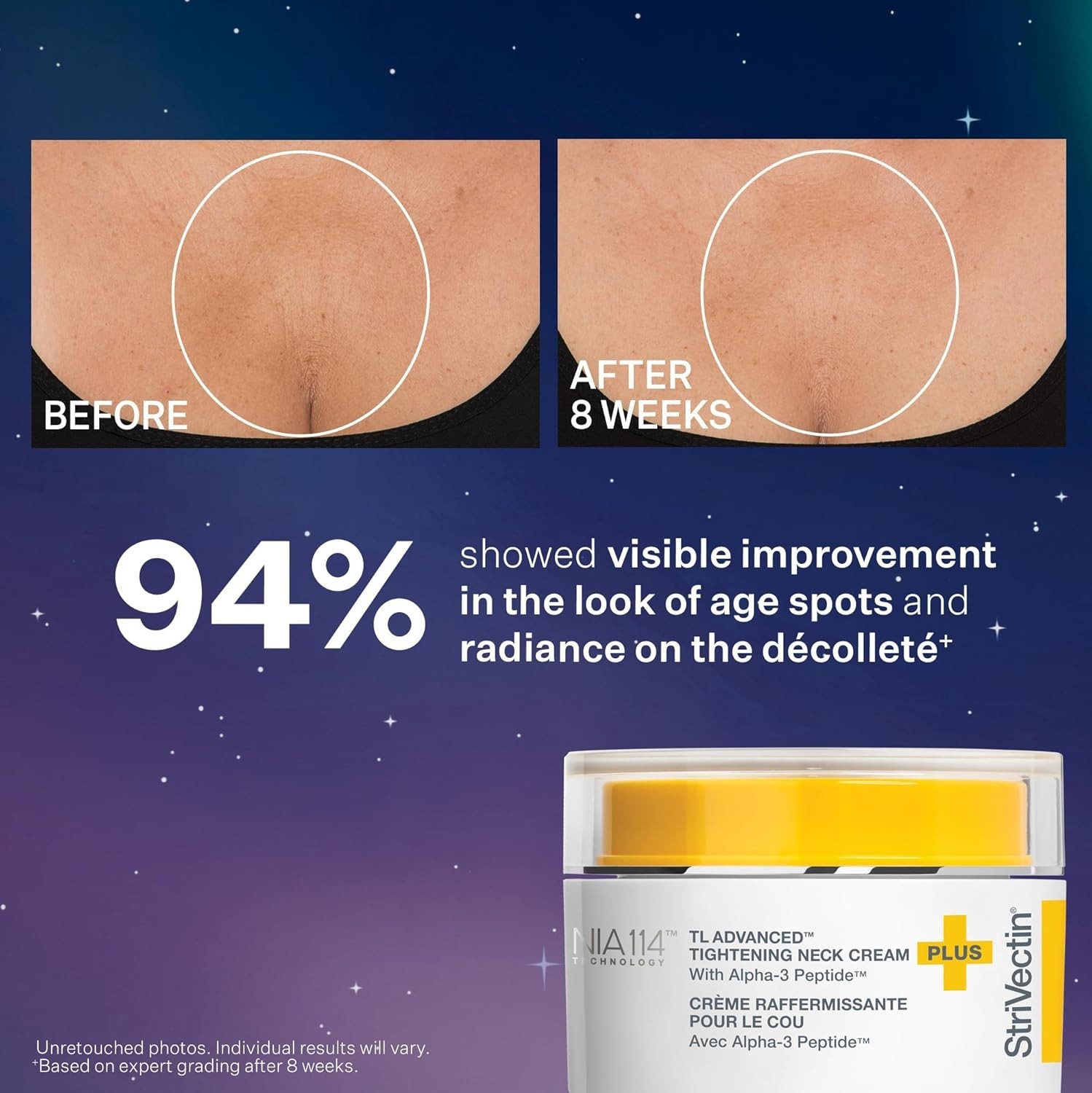 StriVectin TL Advanced™ Holiday Duo Tighten and Sculpt Kit, Brighten and Lift Sk