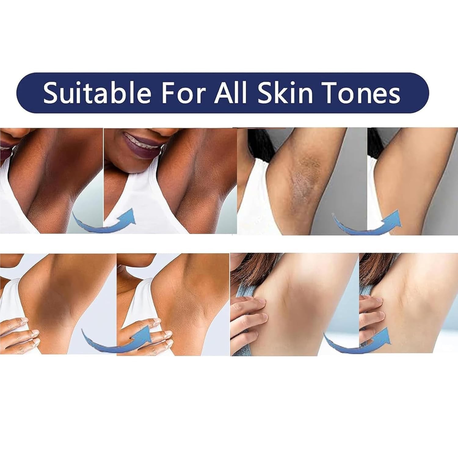 Skin Lightening Cream Dark Spot Remover for Body and Intimate Areas 1oz