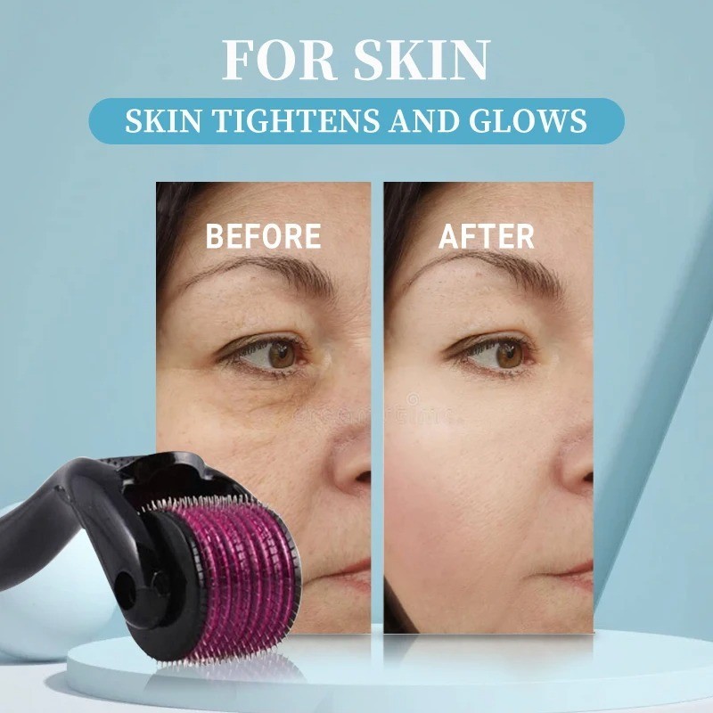 540 Titanium Microneedle Derma Roller 0.25mm 0.5mm 1.0mm 1.5mm 2.0mm Hair Growth