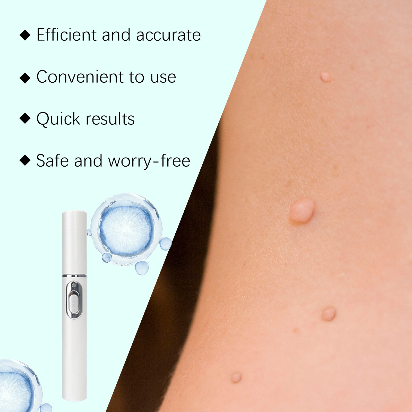 1/2/3X Laser Plasma Pen Mole Removal Dark Spot Skin Wart Tag Tattoo Mole Pen