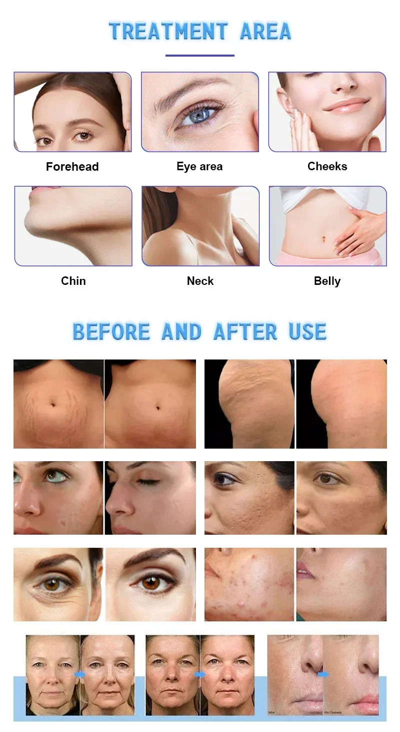 3 in 1 Professional Face Lift Body Slim Skin Firm Skin Rejuvenation Machine