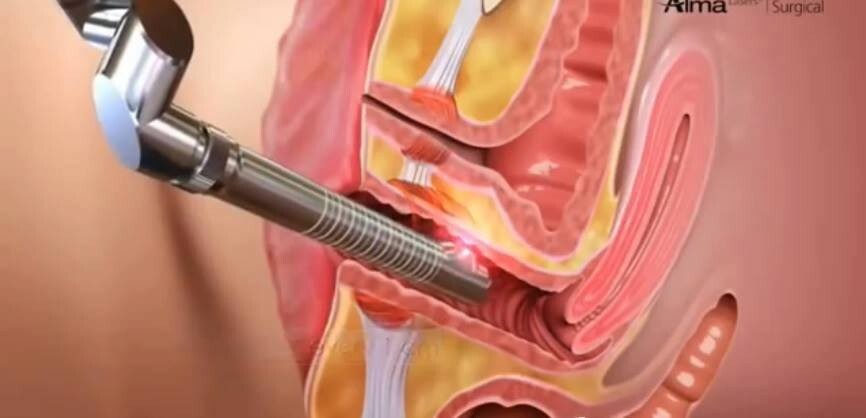Vaginal Tightening Herb Results in Minutes Not For Eat 100% Natural for apply