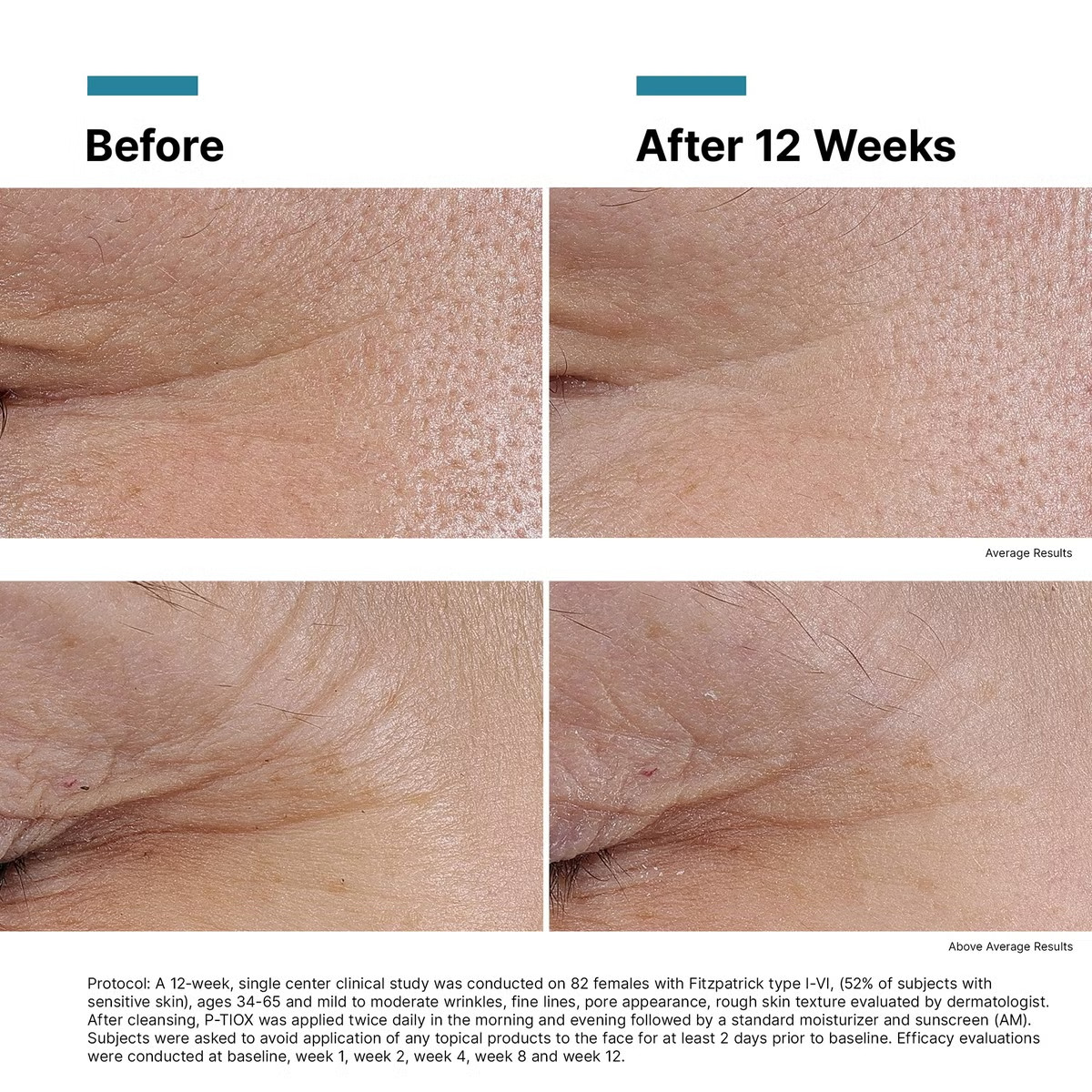 Dermstore – SkinCeuticals P-TIOX Anti-Wrinkle Peptide Serum 1 fl.oz – Save Big