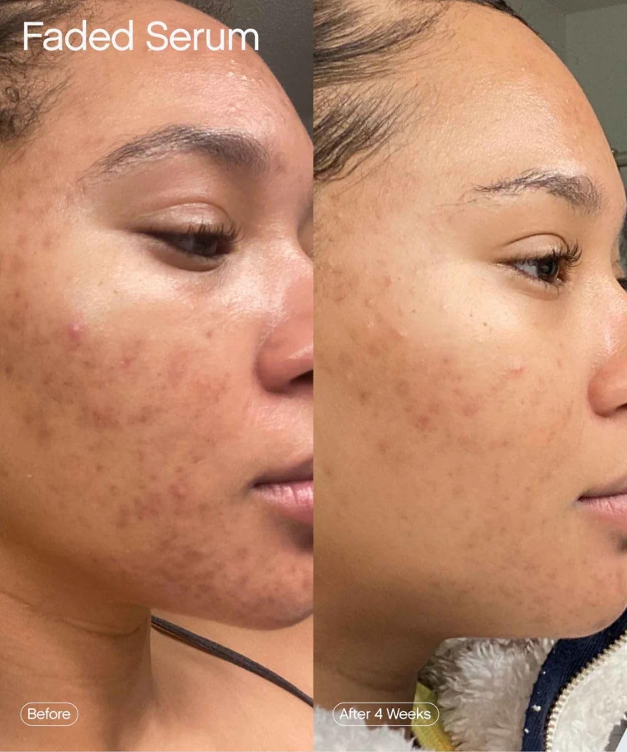 Brightening and Clearing Serum Reduces Discoloration Topicals 1.7 Fl Oz Faded