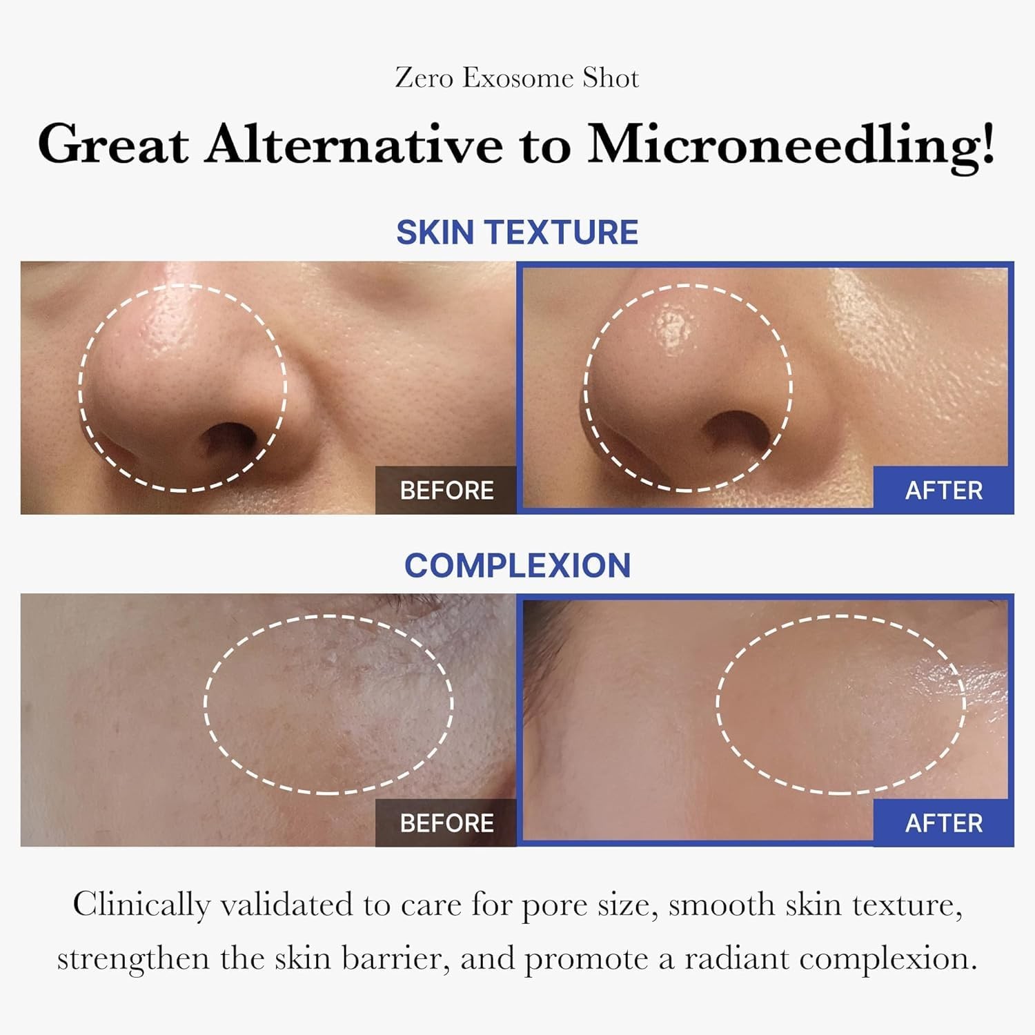 Clinically Proven Exosome Booster: Superior Hydration and Pore Treatment Serum