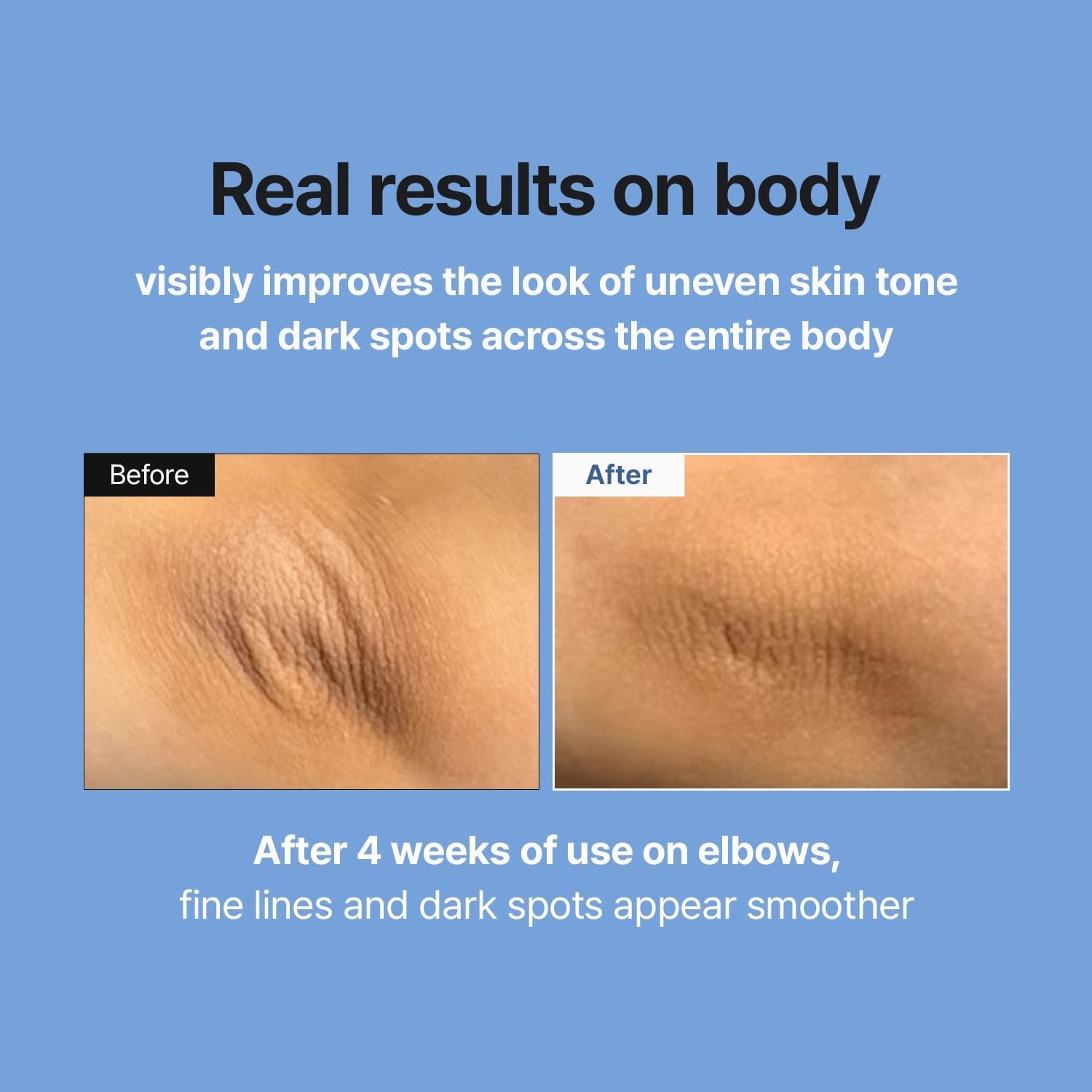 Retinal Skin Booster Serum Anti-Aging Facial Serum Fine Lines Niacinamide