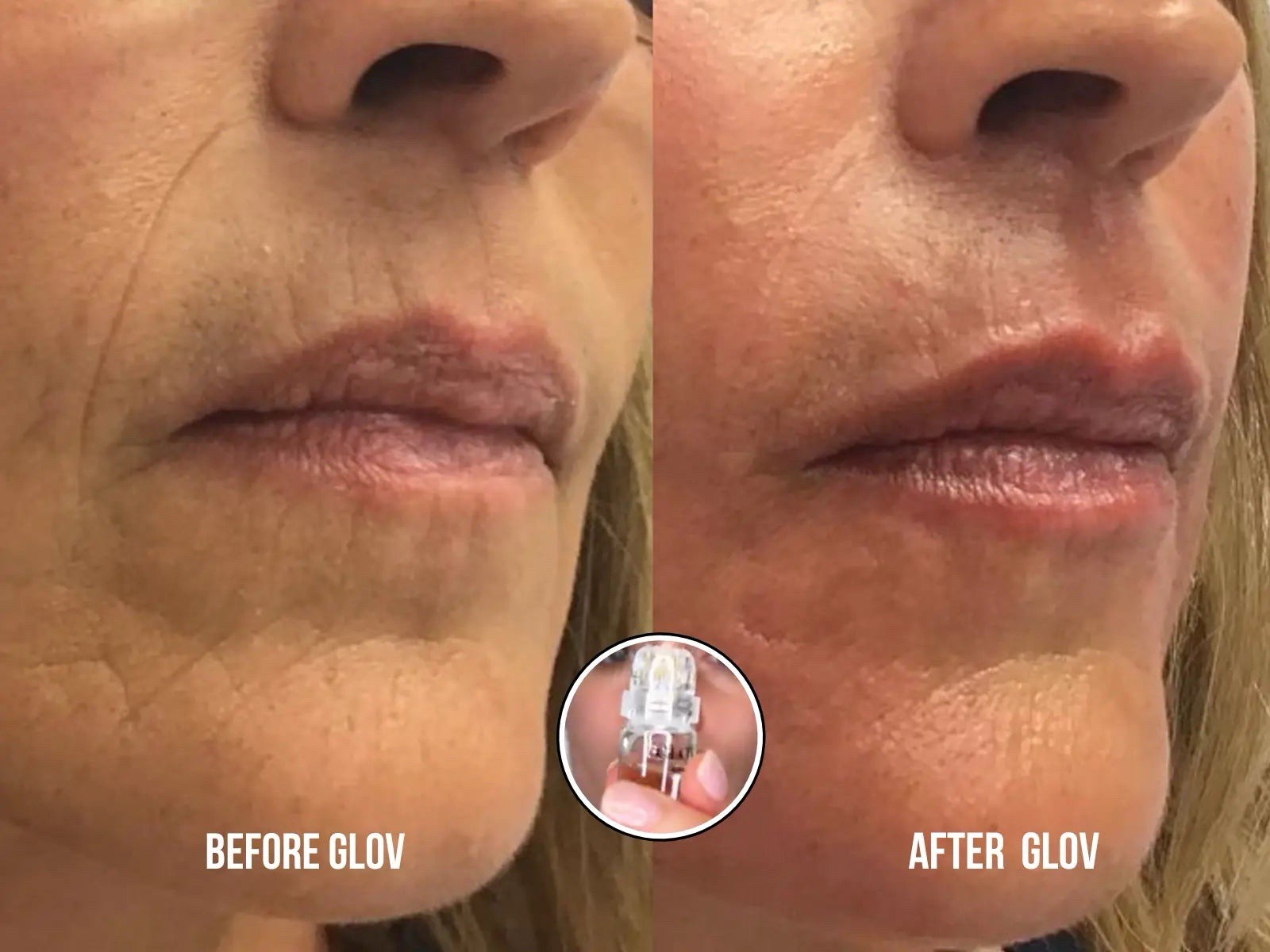 Glov Beauty Micro Infusion System 4X Infusion with 12 Serums NW Sealed Box FR SH