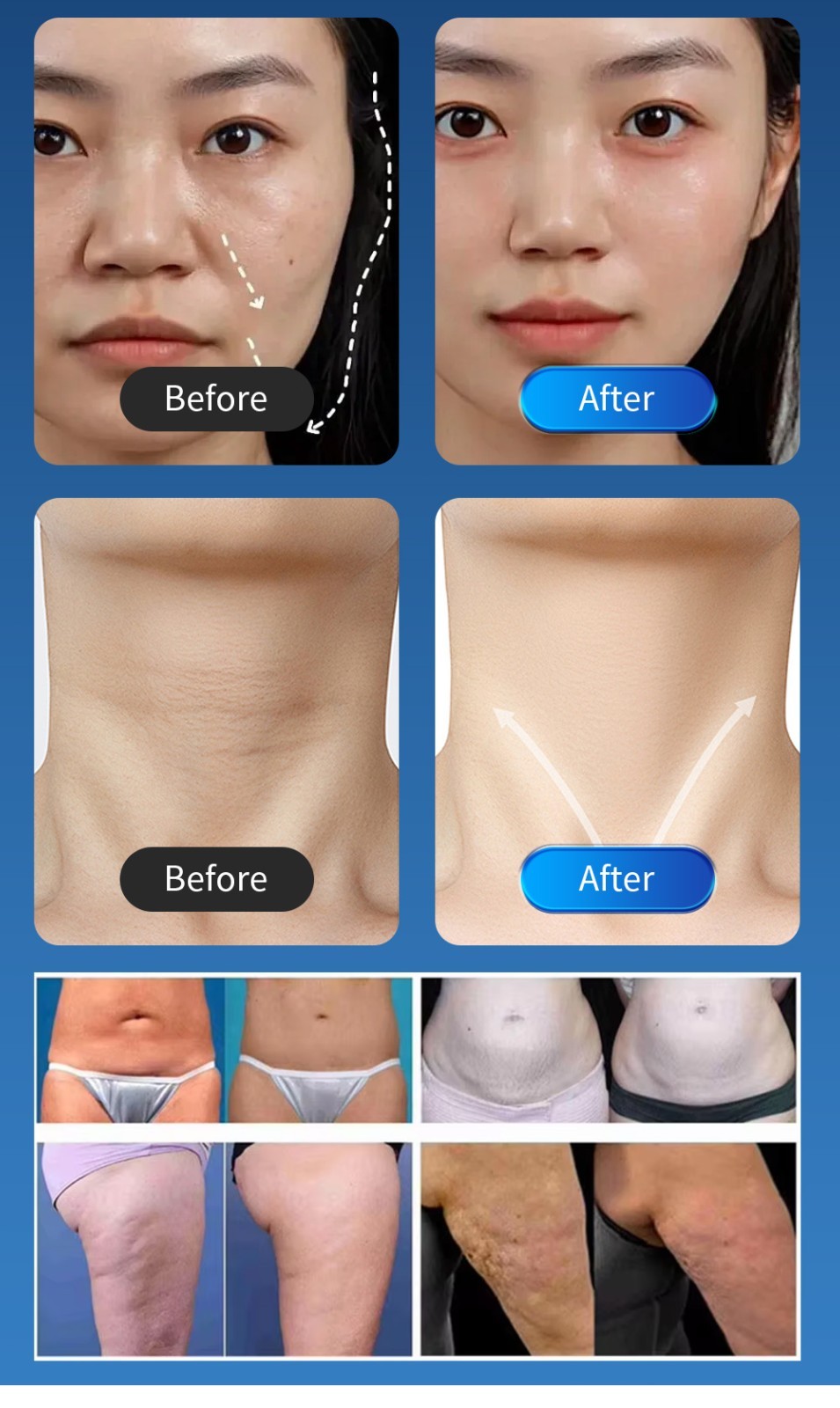 3 in 1 Professional Face Lift Body Slim Skin Firm Skin Rejuvenation Machine