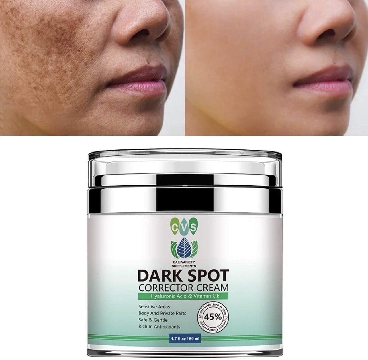 Dark Spot Corrector Face Neck Skin Dark Spot Remover Cream 45% Active Pigment