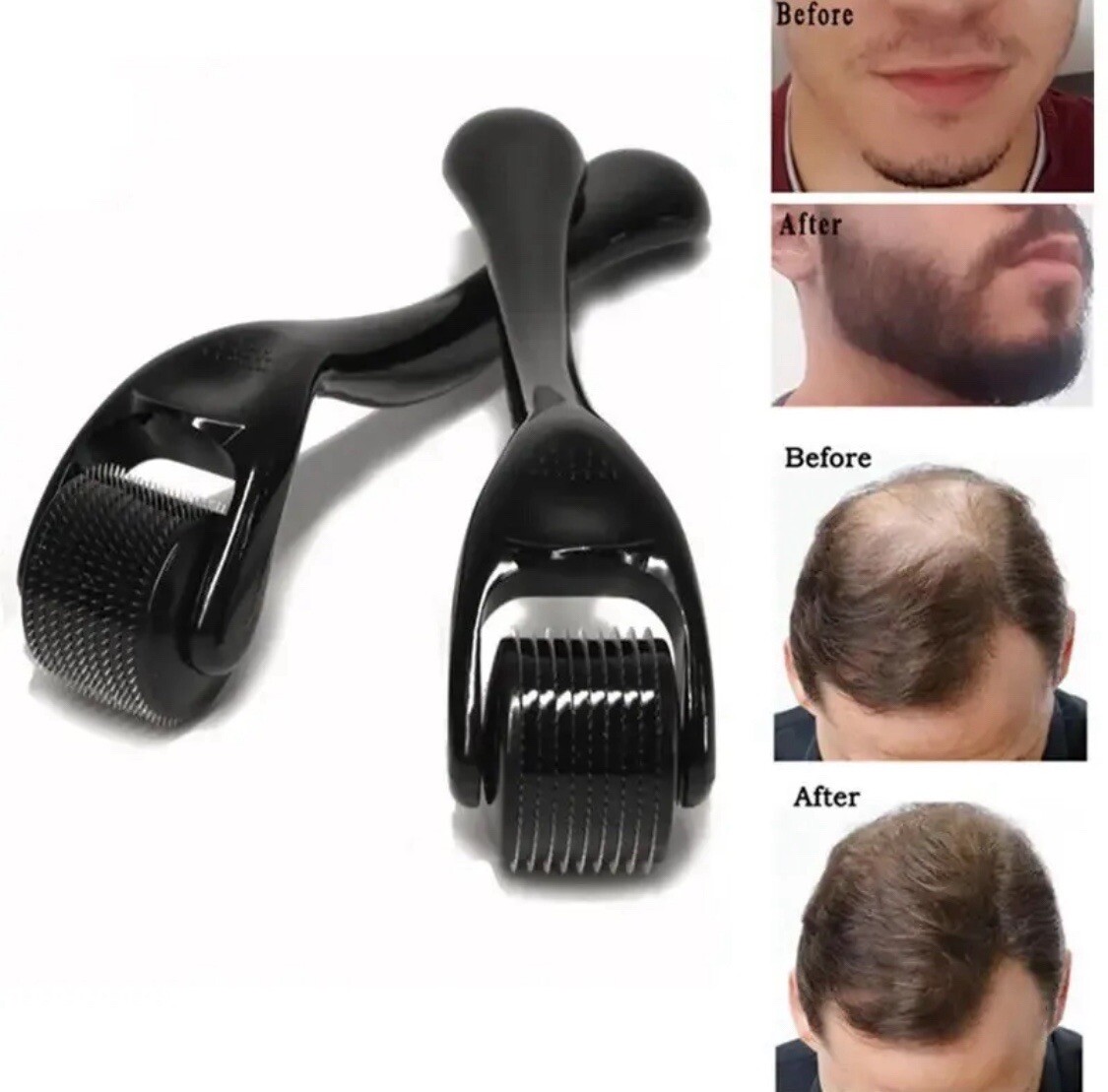 Hair Skin Beard Mustache Activator Beard & Hair Growth Derma Roller Micro Needle