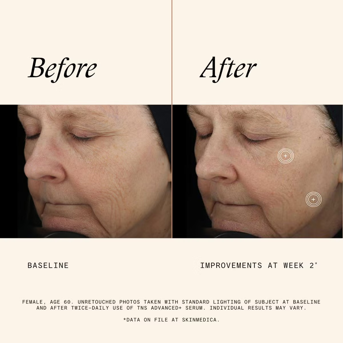 SkinMedica TNS Advanced+ Serum 30ml 1oz AUTHENTIC EXP 11/2027 NEW FAST SHIP