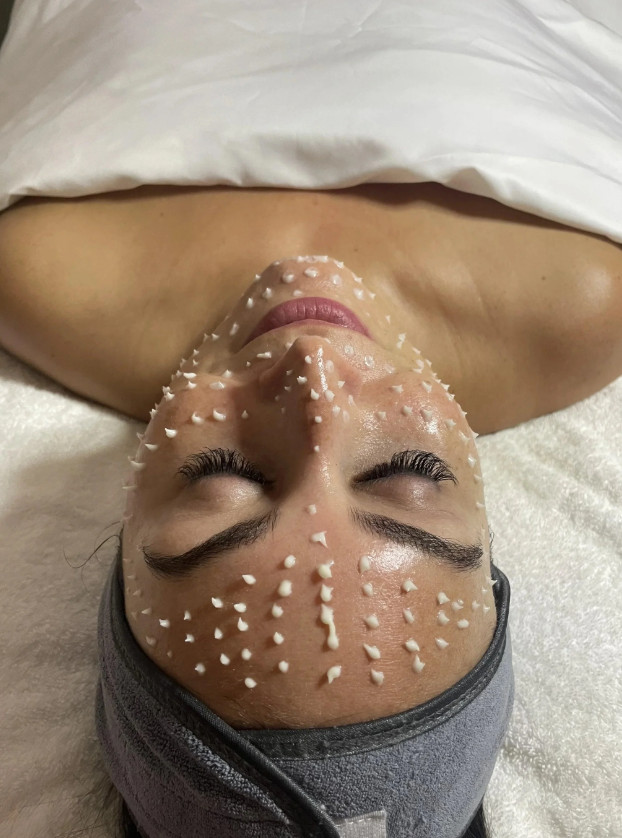 Cell Story Liquid Microneedling