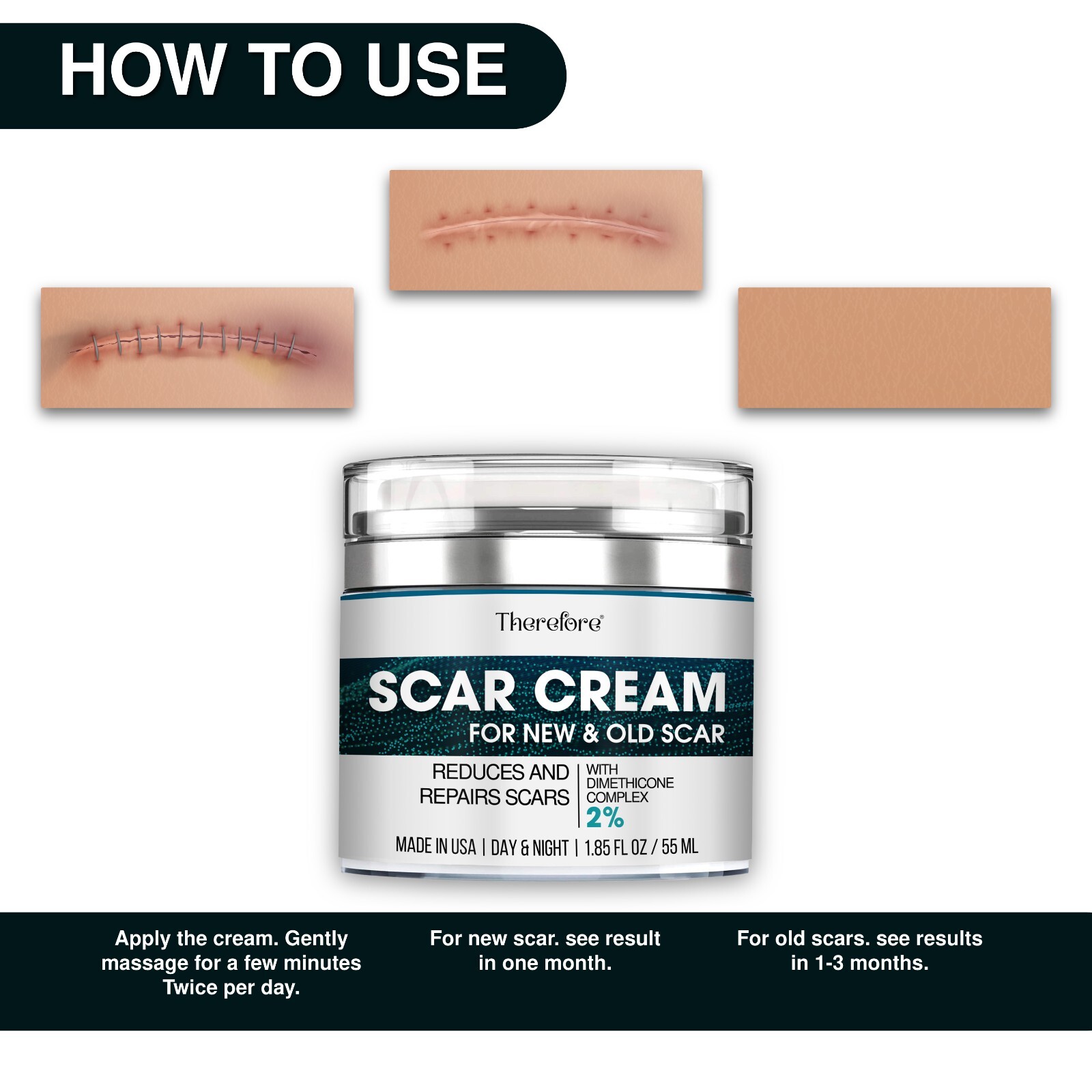 Advanced Scar Cream for Face and Body – Old & New Scar Removal Treatment 1.86 oz