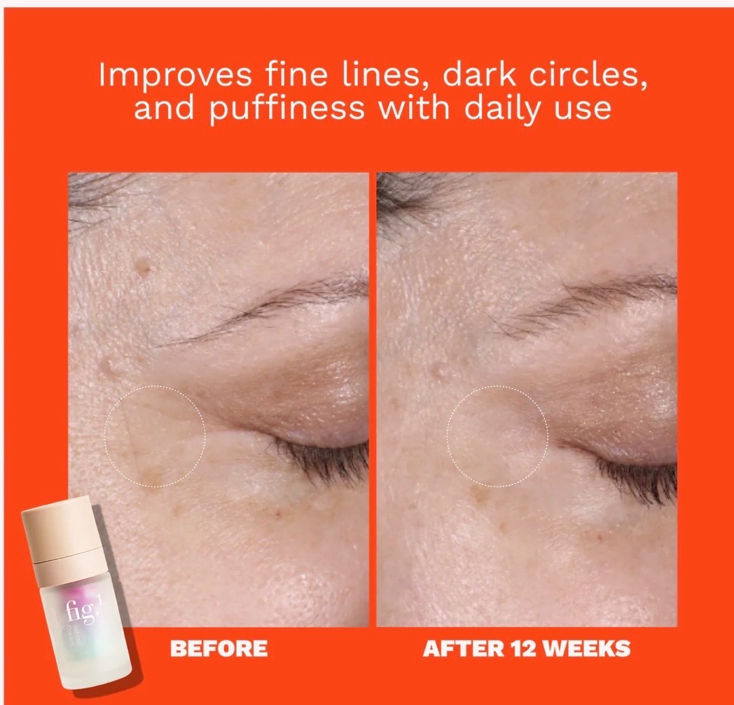Fig 1 Pro Retinol RP Repair Eye Cream Starter Kit Moisturize 0.5 oz – SEALED!!!