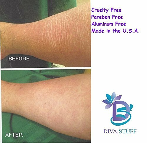 Extreme Crepey Skin Body & Face Cream W/ Hyaluronic Acid, Alpha Hydroxy,Vanilla