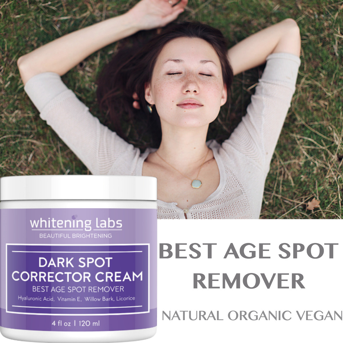 Anti Aging DARK SPOT CORRECTOR for Face, Body Age Spot Remover. MADE in USA 4 OZ