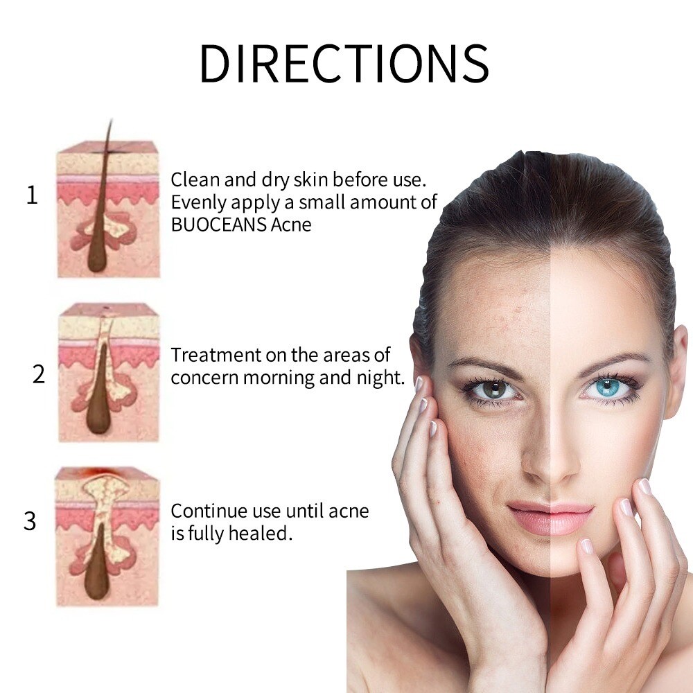 Dark Spot Corrector Face Neck Skin Dark Spot Remover Cream 45% Active Pigment