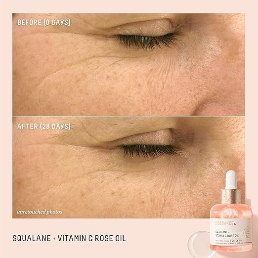 Authentic Biossance Squalane + Vitamin C Rose Oil 30ml Brightening Face Serum