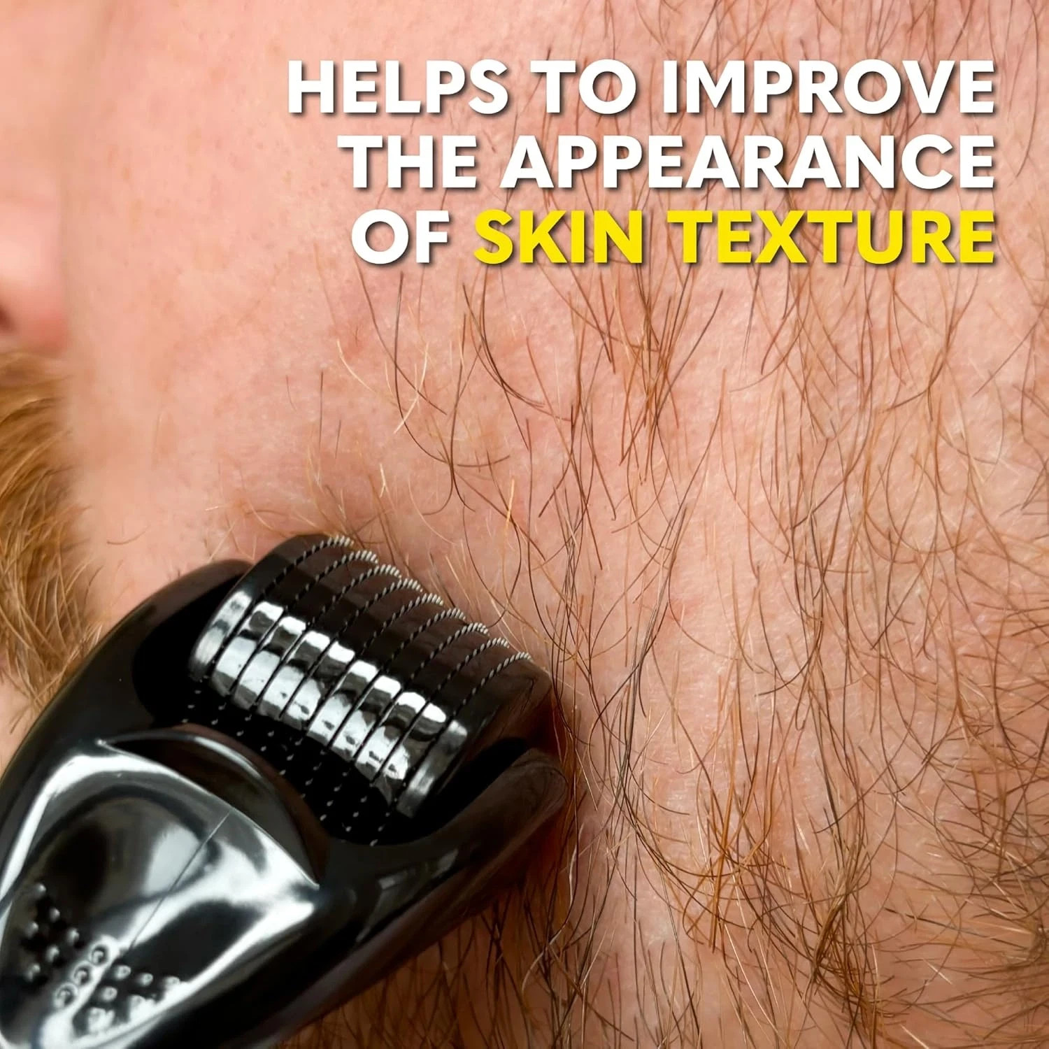 The Beard Club Derma Roller – 540 Titanium Microneedles (Face, Beard & Scalp)