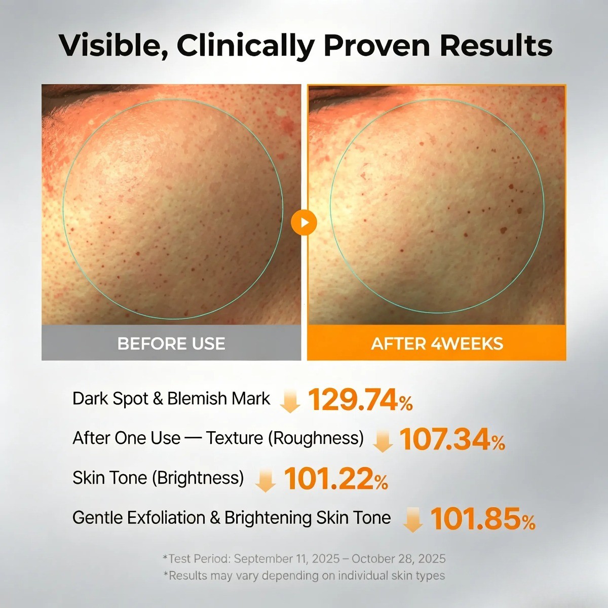 Dr. Melaxin Kojic Acid & Turmeric TX Toner Pad – Dark Spot & Pigmentation Care