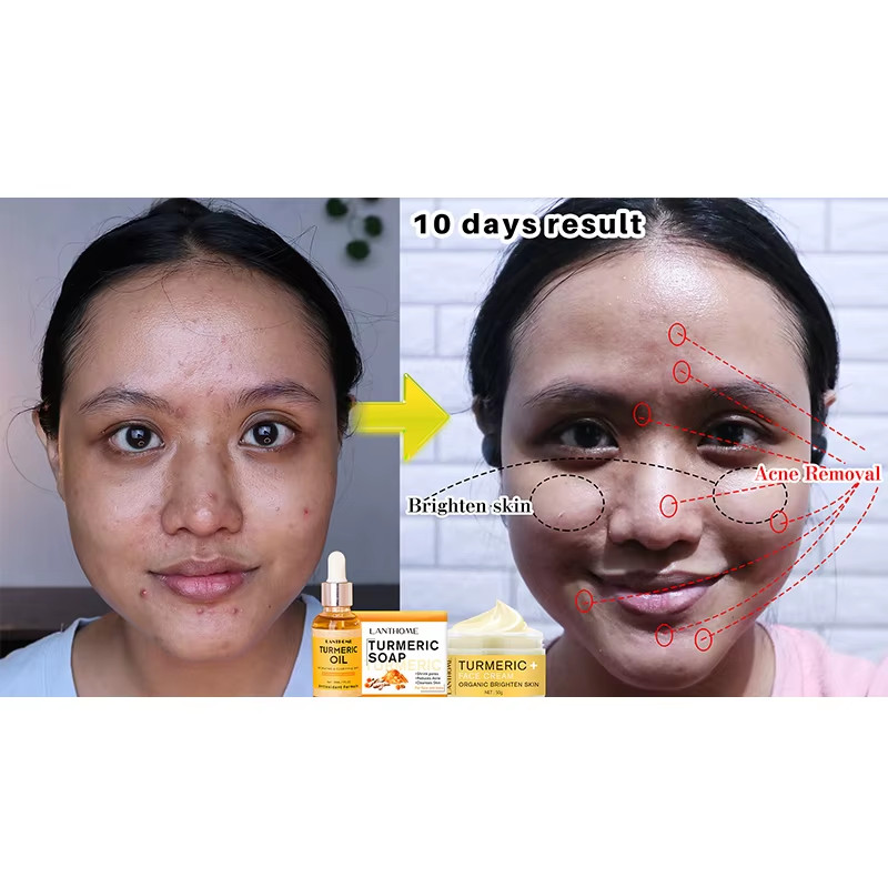 3PCS Turmeric Face Care Kit Skin Brightening Turmeric Soap Whitening Oil