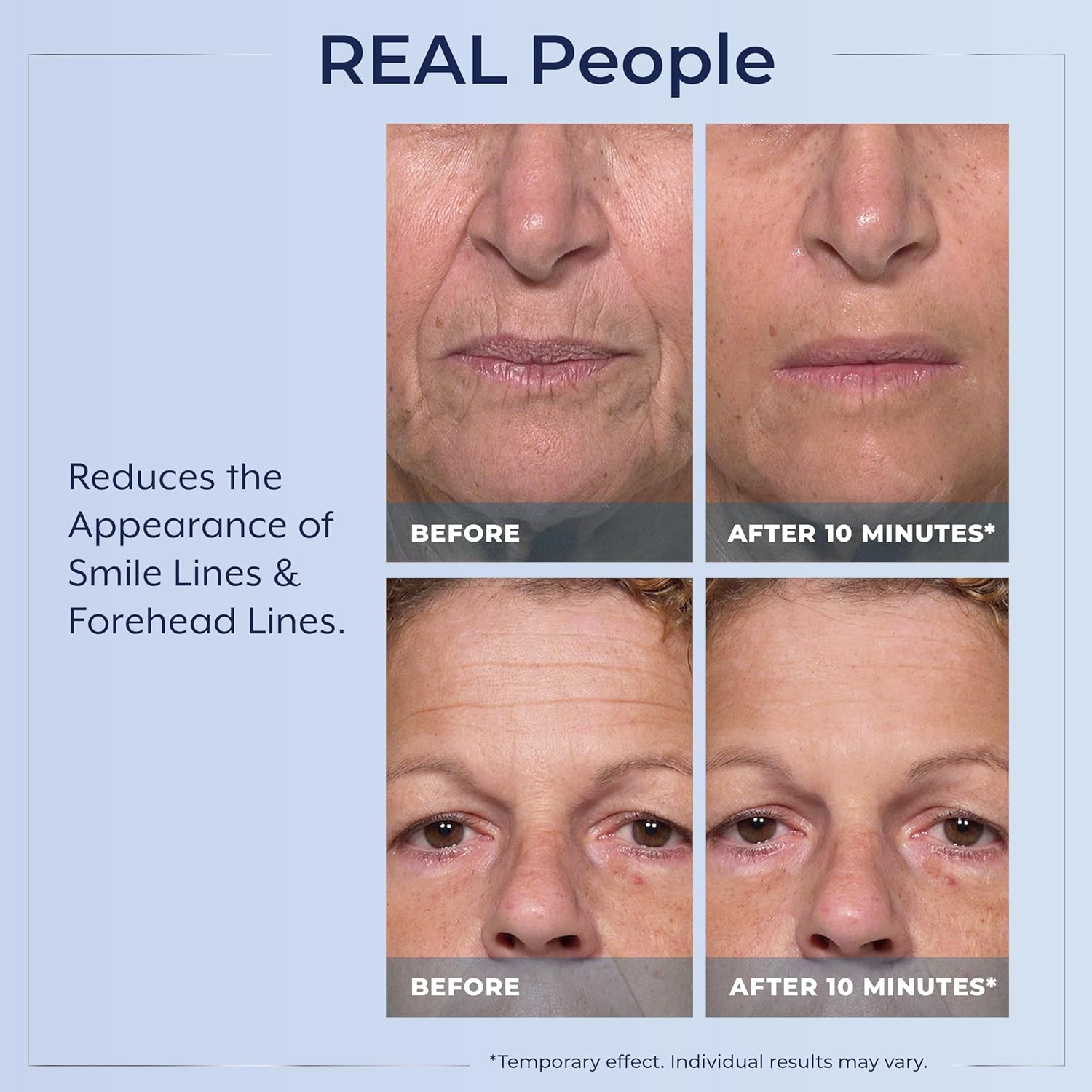 Rapid Reduction Plexaderm Eye Serum Reduces Under Eye Bags Dark Circles Wrinkles